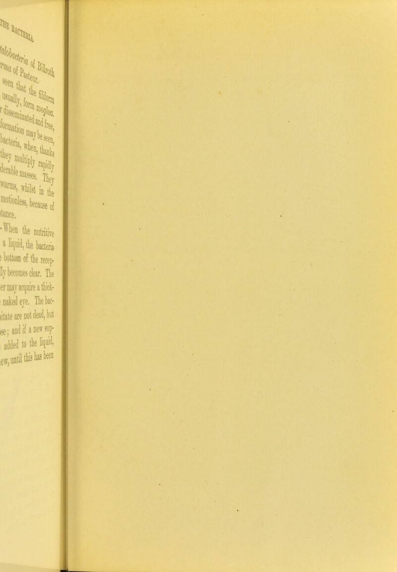 bacteria 7^^^% 'l^* masse, \C wWlst h k because of itance. •^ben the nutritive iybecomesclear, The erniavacquireatliick- ' naked eje. Tie be- litatearenotWjbut ise; and if a new sup- added to the Equid, eff, until tbisbas been
