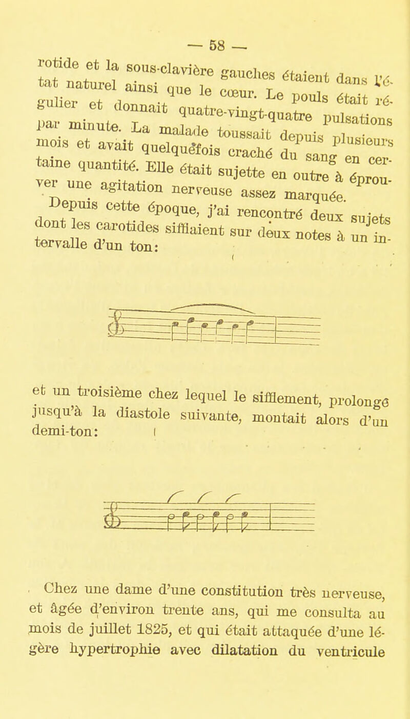 tome quantité. EUe «tait sujet,* en oZVlZ ver une agitation nerreus. assez marquée Depuis cette époque, J'ai rencoutré deux sujets dont es «.rotides sifflaient sur deux notes à nn t tervalle d'un ton: ^ au m et un troisième chez lequel le sifflement, prolonge jusqu'à la diastole suivante, montait alors d'un demi-ton: i r r ^ Chez une dame d'une constitution très nerveuse, et âgée d'environ trente ans, qui me consulta au ,mois de juiUet 1825, et qui était attaquée d'une lé- gère hypertrophie avec dilatation du venti-icule