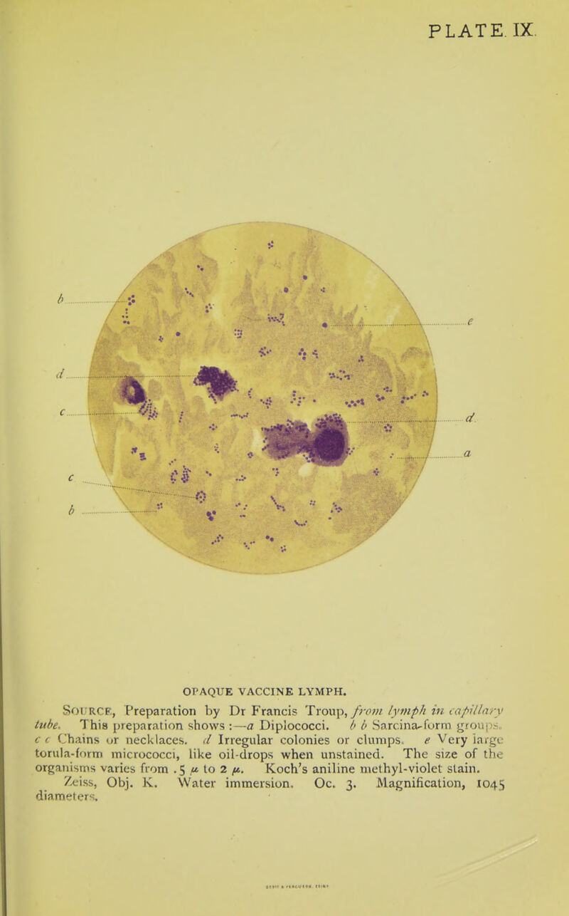 OPAQUE VACCINE LYMPH. Soi;rcf., Preparation by Dr Francis 'Yxo\\\>^ fjovi lymph in iapillary lube. This preparation shows :—a Diplococci. b Sarcina^furm groups. c (. Chains ur necklaces, d Irregular colonies or clumps. e Very iargc torula-fnrm micrococci, like oil-drops when unstained. The size of the organisms varies from .5 ,1* to 2 ^tt. Koch's aniline methyl-violet stain. Zeiss, Obj. K. Water immersion. Oc. 3. Magnification, 1045