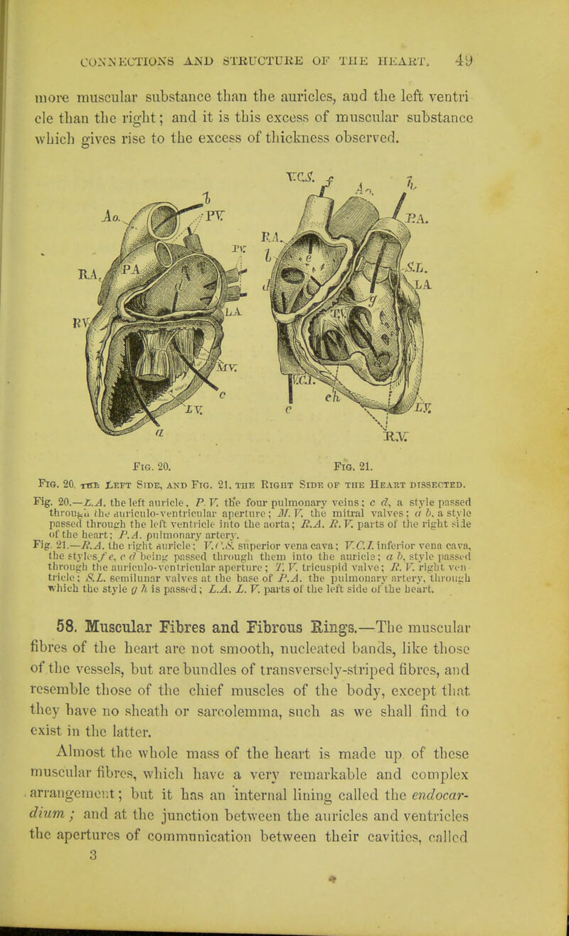 more muscular substance than the auricles, aud the left ventri cle than the right; and it is this excess of muscular substance which gives rise to the excess of thickness observed. Fig. 20. FiG. 21. Fig. 20. niB ^eft Side, akd Ftg. 21. the Right Side of the Heaut dissected. Fig. 20.—Z.A. the left auricle, PV. the four pulinonary veins; c f?, a style passed throu^u the auiiculo-ventrieular aperture ; M. V. the mitral valves; a b, a, style passed throuprh the left ventricle into the aorta; B.A. li.V. parts of the right si.le of the heart; F.A. pulnion.iry arteiy. Fig. 21.—}i.A. the light auricle;' V.<\& superior vena cava; FiC/. inferior vena cava, the ftylos/f, c being passed through them into the nuriels; a ?\ style passed through the auriculo-vcnti-ieular aperture ; 7'. V. tricuspid valve; li. V. right ven tricio; S.L. semilunar valves at the base of F.A. the pulmonary artery, through which the style (/ A is passed; L.A. L. V. parts of the left side of the heart. 58. Muscular Fibres and Fibrous Eings.—The muscular fibres of the heart are not smooth, nucleated bands, like those of the vessels, but are bundles of transversely-striped fibres, and resemble those of the chief muscles of the body, except that they have no sheath or sarcolemma, such as we shall find to exist in the latter. Almost the whole mass of the heart is made up of these muscular fibres, which have a very remarkable and complex . arrangement; but it has an internal lining called the endocar- dium ; and at the junction between the auricles and ventricles the apertures of commnnication between their cavities, called 3