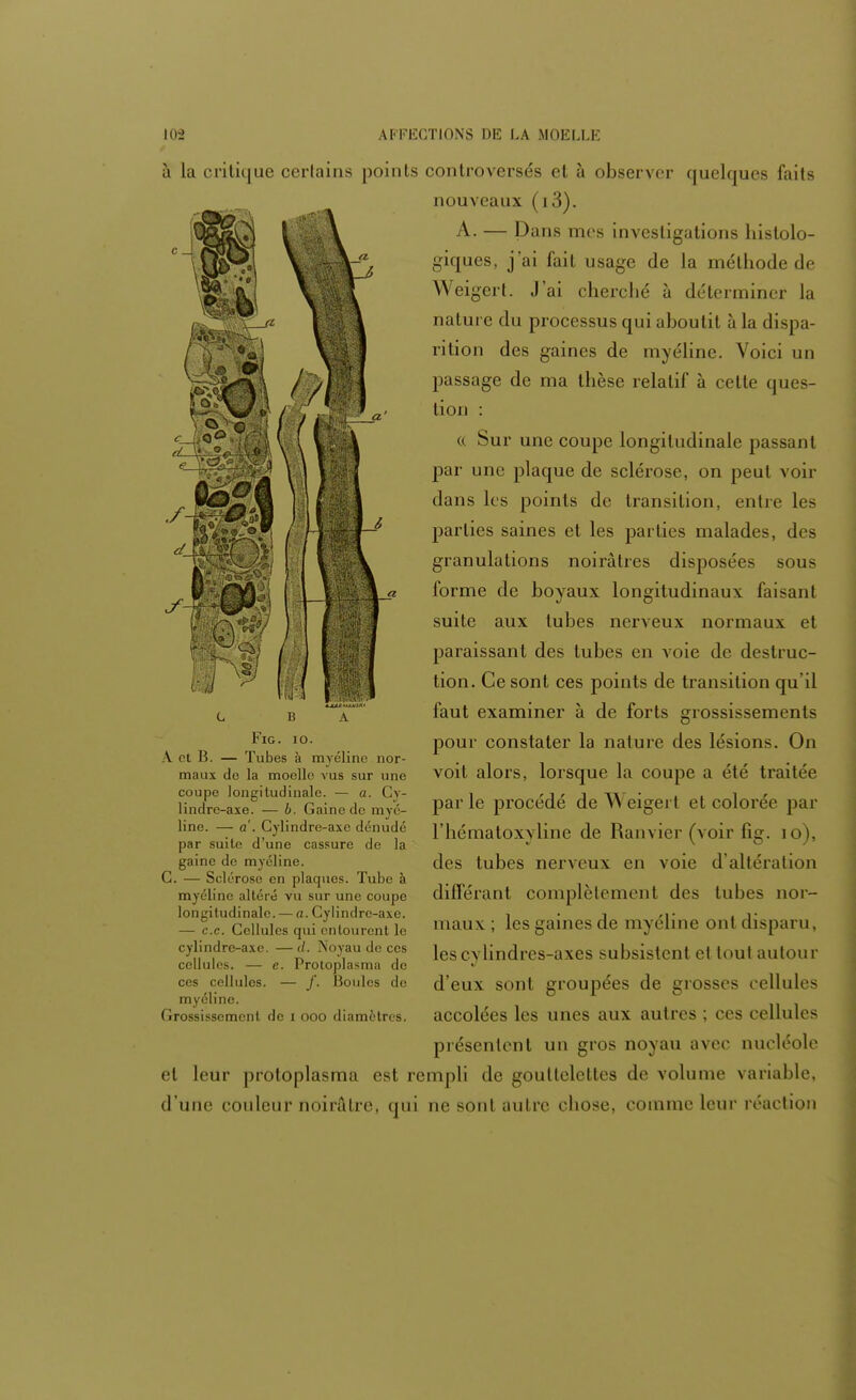 à la critique certains points controversés cl à observer quelques faits nouveaux (i3). A. — Dans mes investigations histolo- giques, j ai fait usage de la méthode de Weigert. J'ai cherché à déterminer la nature du processus qui aboutit ù la dispa- rition des gaines de myéline. Voici un passage de ma thèse relatif à cette ques- tion : a Sur une coupe longitudinale passant par une plaque de sclérose, on peut voir dans les points de transition, entre les parties saines et les parties malades, des granulations noirâtres disposées sous l'orme de boyaux longitudinaux faisant suite aux tubes nerveux normaux et paraissant des tubes en voie de destruc- tion. Ce sont ces points de transition qu'il faut examiner à de forts grossissements pour constater la nature des lésions. On voit alors, lorsque la coupe a été traitée parle procédé de Weigert et colorée par l'hématoxyline de Ranvier (voir fig. io), des tubes nerveux en voie d'altération différant complètement des tubes nor- maux ; les gaines de myéline ont disparu, les cylindres-axes subsistent et tout autour d'eux sont groupées de grosses cellules accolées les unes aux autres ; ces cellules présentent un gros noyau avec nucléole et leur protoplasma est rempli de gouttelettes de volume variable, d'une couleur noirâtre, qui ne sont autre chose, comme leur réaction HP L B A Fie. io. V ot B. — Tubes à myéline nor- maux de la moelle vus sur une coupe longitudinale. — a. Cv- lindre-axe. — b. Gaine de myé- line. — a'. Cylindre-axe dénudé par suite d'une cassure de la gaine de myéline. C. — Sclérose en plaques. Tube à myéline altéré vu sur une coupe longitudinale. — a. Cylindre-axe. — ce. Cellules qui entourent le cylindre-axe. — </. Noyau de ces cellules. — e. Protoplasma de ces cellules. — f. Boules de myéline. Grossissement de i ooo diamètres.