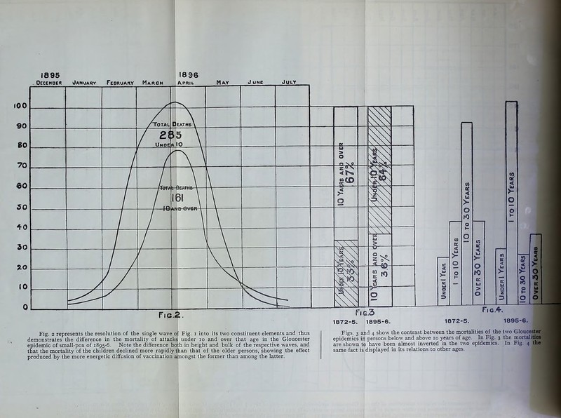 1895 Occehber January February March 1696 April May J UHf July Fig.3 1872-5. 1895-6. 1872-5. Fig. 2 represents the resolution of the single wave of Fig. i into its two constituent elements and thus demonstrates the difference in the mortality of attacks! under io and over that age in the Gloucester epidemic of small-pox of 1895-6. Note the difference both in height and bulk of the respective waves, and that the mortality of the children declined more rapidly than that of the older persons, showing the effect produced by the more energetic diffusion of vaccination amongst the former than among the latter. Figs. 3 and 4 show the contrast between the mortalities of the two Glouces epidemics irj persons below and above 10 years of age. In Fig. 3 the mortali are shown to have been almost inverted in the two epidemics. In Fig. 4 same fact is. displayed in its relations to other ages.