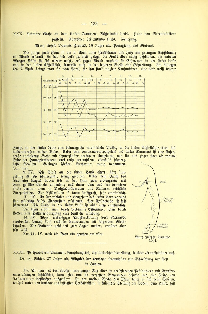 XXX. '^Jrimäre 33Iafe an bcm Unfett Baumen; 2l(i)felbubo ünU. ^ont üon ©treptofoffcn- puftetn. 2lborttoer ^ciftentmbo ünU. ©enefung. Wim) Qofefa ©ominic gronctö, 18 3a^re ah, '^Portugtefin au8 SlJJabraS. ÜDte junge jarte x^xaa ift am 5. 2lprt[ unter j^foftfc^ouer unb §t^e mit geringem ^opffdjmer^ am ?lbenb erfranft; fie \)üt fi(^ ba(b jju 33ett gelegt, bie 9?ar^t über ruliig gef(^(afen, am onberen SJforgen füllte fie fic| toieber tuo^I, erft gegen 2tbenb empfanb fie ©(^mer,5eu in ber linten Seifte unb in ber linfen 2l(^fel^ö()Ie, bemerfte aud) an ber legteren ©teUe eine ©t^tuetlung. '31m SJforgen beS 7. 3lpril bringt man fie narf) ^^Jarel, fte ^at ftorf tniijirte S?oniuntttuen, eine bicfe m\\] belegte Krankheitstag 7. April M A 8. M A H. M A 10. M A 11. M A 12. M A M A 14. M A 15. M A \ / . \ Ii *— \ -\ \ A. \ / > r —\7 \ / s.' 20 P T 120 37° 3unge, in ber linfen Seifte eine bo^nengroße empfinbü^e ®rüfe; in ber Unfen 2lc^feir)öf)te einen faft taiibeneigroßen >üeirt)en 33ubo. Ueber bem Sarpoiuetocarpatgefenf beä Unten ®Qumenö ift eine Iinfen= große bunfelrotiie Slafe mit fd)mersI)Qfter geröttjeter Umgebung, pon it)r quö äie()eu über bie rabiate ©eite ber §anbge(entgegenb jlnei rottie Derluafebene, ebenfalls f(|mer5= (lafte Streifen. ©eringeö gieber; ©enforium wenig benommen. 33Iut fteril. 9. IV. ÜDte 58Iofe an ber tint'en $anb eitert; ifjre Unu gebung ift fe^r fc^mer;5^aft, lüenig gerottet. Ueber bem 5öau(^ beä ©upinator longuS baben fi^ in ber §aut ^iüei erbfengroße mit Siter gefüüte $ufteln entioicEelt; au8 i^nen folüie au8 ber primären ^ötafe gewinnt man in ©ecfglaSpräparaten unb Ä'utturen reicbütbe ©treptoEoften. ®er ?(fif(avbubo ift faum firfc^groß, fe()r empfinbli^. 10. IV. ?tn ber rabiaten unb 33eugefeite beS (inten 33orberarmeö finb jal)trei(|e frifd)e ©iterpuftetn crft^ienen. 5)er ^tpßarbubo ift faft f(|merjto8. üDie ®rüfe in ber linten Seifte ift n\6)t me^r empftnbtid). Urin erhält man burtb üerbiinnte (äffigfäure, fomie bur(b Podien unb ©atpeterfäuresufa^ eine beutlicbe Trübung. 14. IV. 3Begen mehrtägiger ©tu^tüertialtung wirb S^icinuäot üerabreic^t; banac^ fünf rei(^li($e (Entleerungen mit fotgenbem SBot](= befinben. 3)ie Patientin gebt feit ;^lBei Stögen umt)er, ermübet ober fe^r rafcb. 3tm 21. IV. wirb bie grau ol8 genefen cntlaffen. Waxi) 3ofepf)a ®ominic. 10./4. XXXI. ^eftpuftel am Daumen, Sijmp^angttig, 5(j:i[(arbrüfenf(i)H)e(hing, tctcf)ter ^ranftjcit^ucvlauf. Dr. ®. ©tider, 37 öa^re alt, SOtitglieb ber beutf(^en IJommiffion jur (ärforfc^ung ber ^eft in 3;nbien. Dr. ©t. war feit brei 2Bo(5en ben ganjen Sag über in üerfi^iebenen ^^eftfpitätern mit Sranfen= unterfud)ungen bef(^äftigt, batte l)ier unb ba üerpeftete SBobnungen befud)t unb eine 9^eibe uon ©ettionen an '!|3efttei^en auSgefübrt. 3n ber ,:^weiten SBodbe be« DJJärj batte er beim ©e5iren, Welcbeö unter ben bentbar ungünftigften S3erbältniffen, in tnieenber ©tetlung am Soben, ot)ne §ulfe, faft
