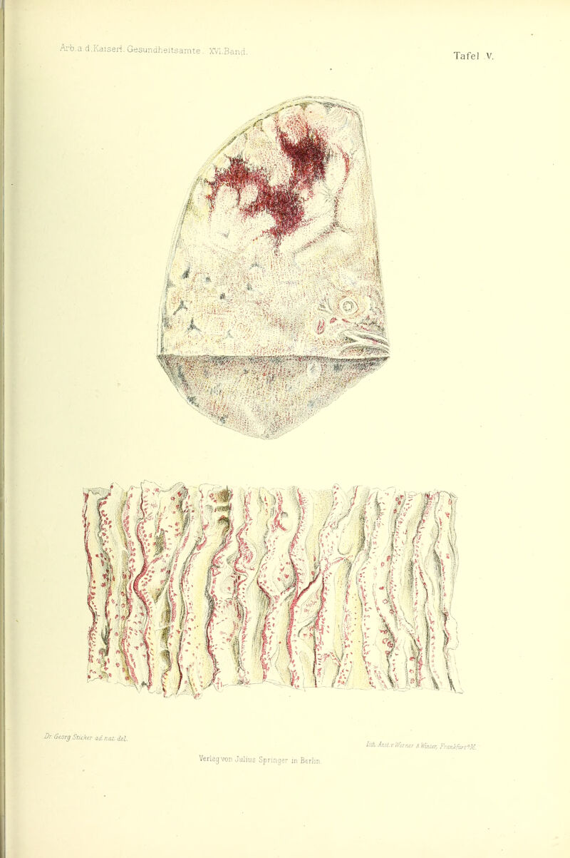 Tafel V. Georg Sticker adnaz. del. /iit /«i r. mriur H Wuiur, Frankfmm.