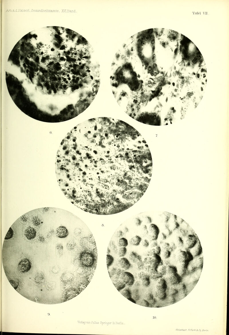Ai'o.a.d.Kaiserl, Gesundheilsamte, XVI.Band. Tafel \1I 9. 10. TerkgT^n Julius Springer in Berlin. Meisenbsch Hiffurfl, t Ca, ßer/in