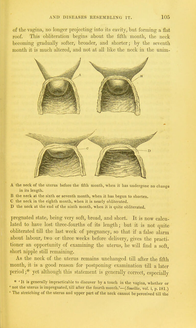 of the vagina, no longer projecting into its cavity, but forming a flat roof. This obliteration begins about the fifth month, the neck becoming gradually softer, broader, and shorter; by the seventh month it is much altered, and not at all like the neck in the unim- A the neck of the uterus before the fifth month, when it has undergone no change in its length. B the neck at the sixth or seventh month, when it has begun to shorten. C the neck in the eighth month, when it is nearly obliterated. D the neck at the end of the ninth month, when it is quite obliterated. pregnated state, being very soft, broad, and short. It is now calcu- lated to have lost three-fourths of its length; but it is not quite obliterated till the last week of pregnancy, so that if a false alarm about labour, two or three weeks before delivery, gives the practi- tioner an opportunity of examining the uterus, he will find a soft, short nipple still remaining. As the neck of the uterus remains unchanged tiU after the fifth month, it is a good reason for postponing examination tiU a later period ;* yet although this statement is generally correct, especially * ' It is generally impracticable to discover by a touch in the vagina, whether or ' not the uterus is impregnated, till after the fourth month.'—{Smellie, vol. i, p. 181.) ' The stretching of the uterus and upper part of the neck cannot be perceived till the