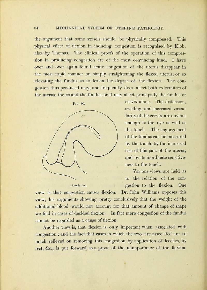 the argument that some vessels should be physically compressed. This physical effect of flexion in inducing congestion is recognised by Klob, also by Thomas. The clinical proofs of the operation of this compres- sion in producing congestion are of the most convincing kind. I have over and over again found acute congestion of the uterus disappear in the most rapid manner on simply straightening the flexed uterus, or so elevating the fundus as to lessen the degree of the flexion. The con- gestion thus produced may, and frequently does, affect both extremities of the uterus, the os and the fundus, or it may affect principally the fundus or cervix alone. The distension, swelhng, and increased vascu- larity of the cervix are obvious enough to the eye as well as the touch. The engorgement of the fundus can be measured by the touch, by the increased size of this part of the uterus, and by its inordinate sensitive- ness to the touch. Various views are held as to the relation of the con- Anteflexion. gestiou to the flcxiou. One view is that congestion causes flexion. Dr. John Williams opposes this view, his arguments showing pretty conclusively that the weight of the additional blood would not account for that amount of change of shape we find in cases of decided flexion. In fact mere congestion of the fundus cannot be regarded as a cause of flexion. Another view is, that flexion is only important when associated with congestion ; and the fact that cases in which the two are associated are so much relieved on removing this congestion by apphcation of leeches, by rest, &c., is put forward as a proof of the unimportance of the flexion.