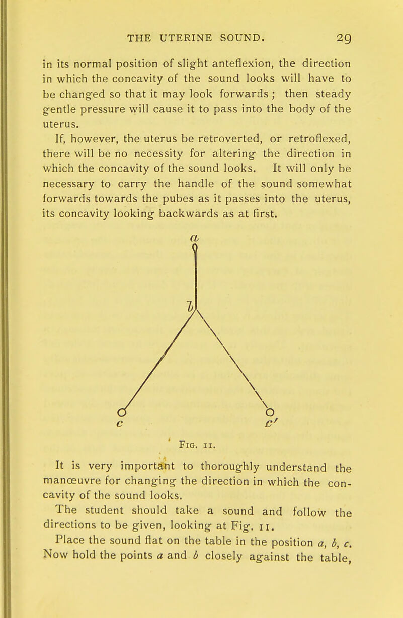 in its normal position of slight anteflexion, the direction in which the concavity of the sound looks will have to be changed so that it may look forwards ; then steady gentle pressure will cause it to pass into the body of the uterus. If, however, the uterus be retroverted, or retroflexed, there will be no necessity for altering the direction in which the concavity of the sound looks. It will only be necessary to carry the handle of the sound somewhat forwards towards the pubes as it passes into the uterus, its concavity looking backwards as at first. cv 0 Fig. II. It is very important to thoroughly understand the manoeuvre for changing the direction in which the con- cavity of the sound looks. The student should take a sound and follow the directions to be given, looking at Fig. 11. Place the sound flat on the table in the position a, b, c. Now hold the points a and b closely against the table,