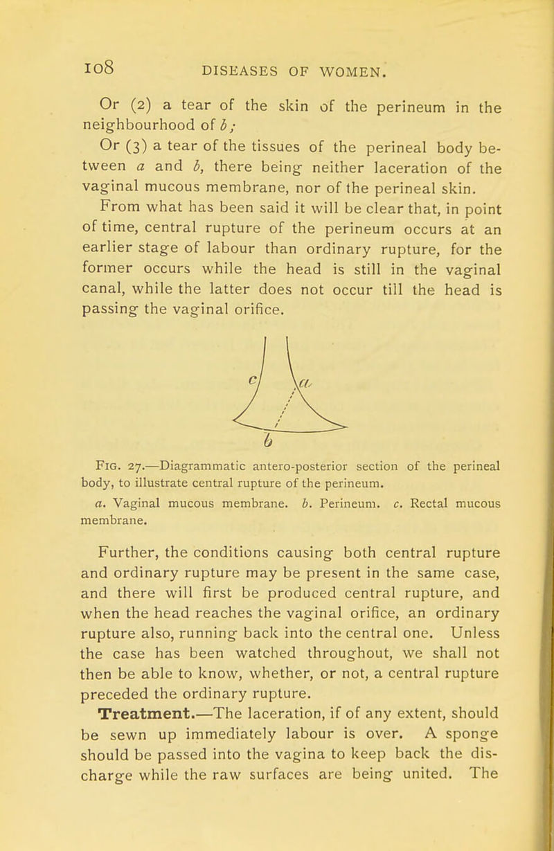 io8 Or (2) a tear of the skin of the perineum in the neighbourhood of b; Or (3) a tear of the tissues of the perineal body be- tween a and b, there being- neither laceration of the vaginal mucous membrane, nor of the perineal skin. From what has been said it will be clear that, in point of time, central rupture of the perineum occurs at an earlier stage of labour than ordinary rupture, for the former occurs while the head is still in the vaginal canal, while the latter does not occur till the head is passing the vaginal orifice. Fig. 27.—Diagrammatic antero-posterior section of the perineal body, to illustrate central rupture of the perineum. a. Vaginal mucous membrane, h. Perineum, c. Rectal mucous membrane. Further, the conditions causing both central rupture and ordinary rupture may be present in the same case, and there will first be produced central rupture, and when the head reaches the vaginal orifice, an ordinary rupture also, running back into the central one. Unless the case has been watched throughout, we shall not then be able to know, whether, or not, a central rupture preceded the ordinary rupture. Treatment.—The laceration, if of any extent, should be sewn up immediately labour is over. A sponge should be passed into the vagina to keep back the dis- charge while the raw surfaces are being united. The
