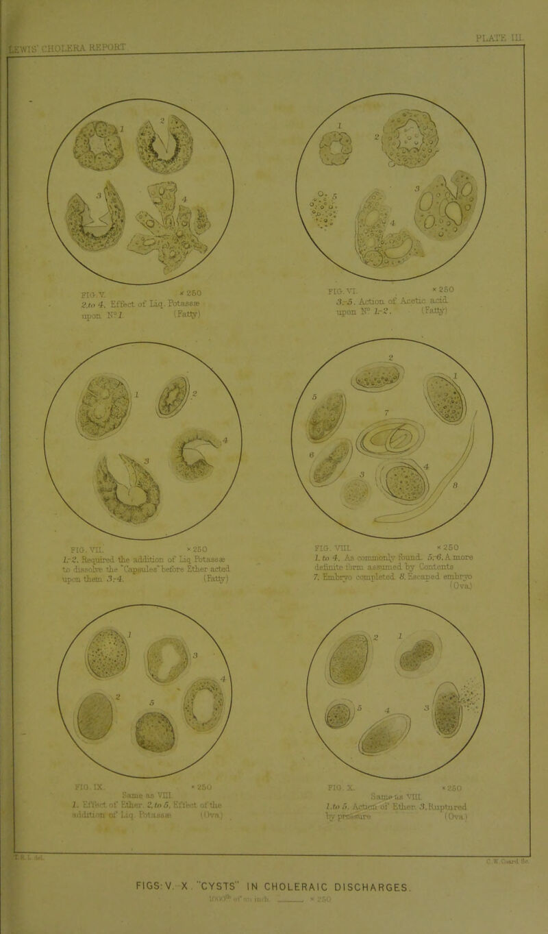 [S' CHOLKRA RKPOKT PTATK !U I- MUi.ptiircd 1 lf>V:ll F1GS:V. X CYSTS IN CHOLERAIC DISCHARGES.