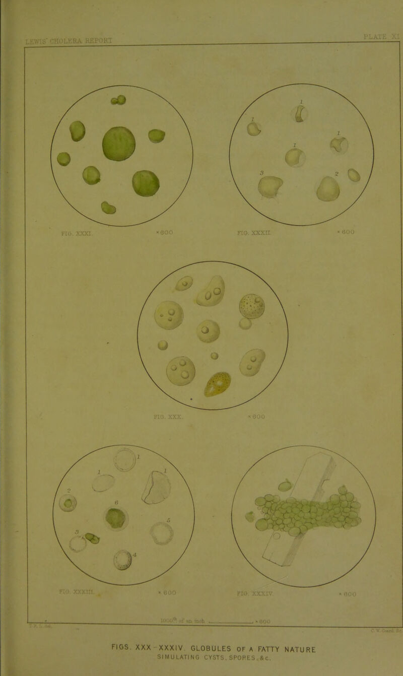 FIGS. XXX XXXIV GLOBULES OF A FATTY NATURE SIMULATING CYSTS. SPOR ES .& c.