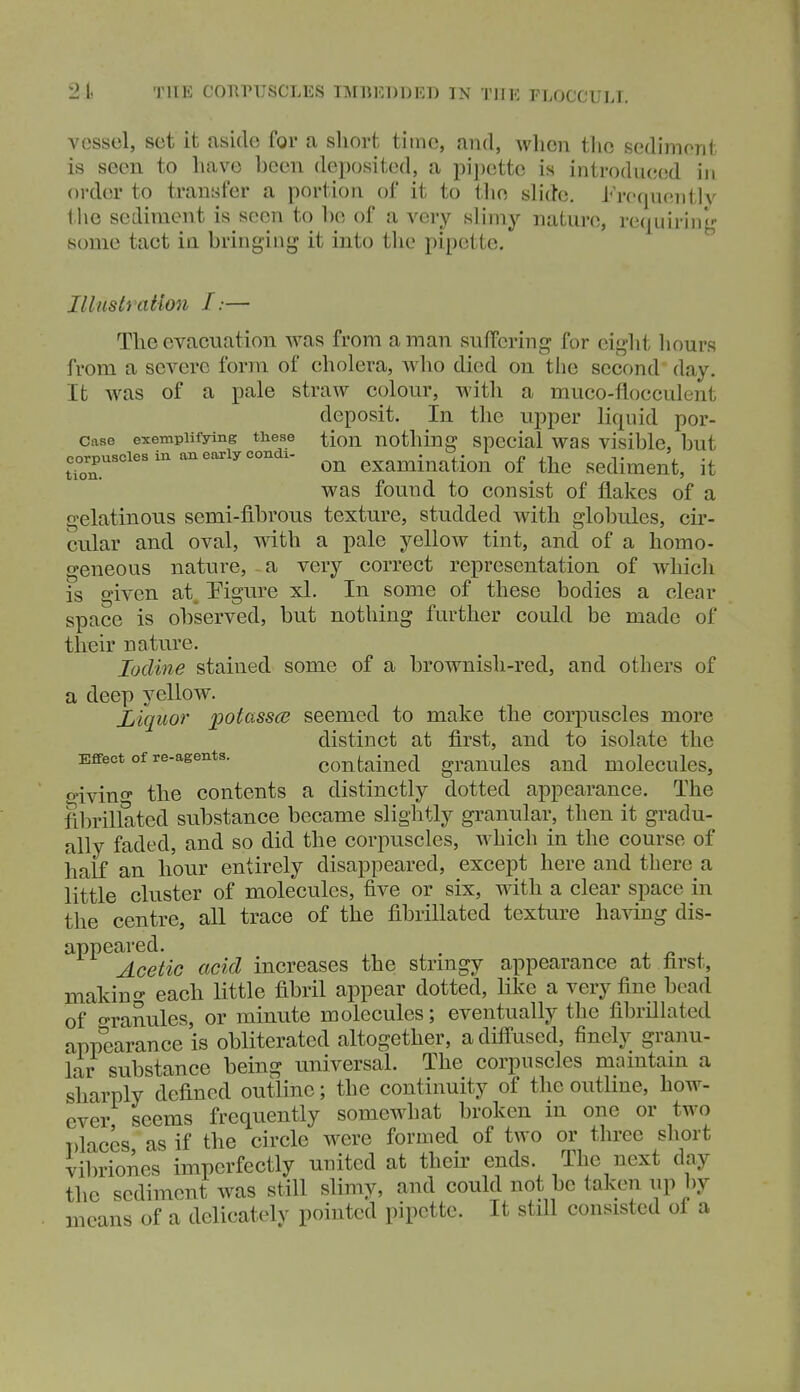 vessel, set it aside for a short time, and, when the sedimont is seen to have been deposited, a jnpette is introdtioed iji order to transfer a portion of it to tlie sh'de. J''rer|neiitlv the sediment is seen to he of a very slimy nature, requiring- some tact in bringing it into the pipette. Illustration I:— The evacuation was from a man suffering for eight liours from a severe form of cholera, who died on the second day. It was of a pale straw colour, with a muco-flocculent deposit. In the upper liquid por- case exemplifying these tiou nothing spccial was visible, but corpuscles in an ea^iycondx. examination of the Sediment, it was found to consist of flakes of a gelatinous semi-fibrous texture, studded with globules, cir- cular and oval, with a pale yellow tint, and of a homo- geneous nature, a very correct representation of which is given at. Eigure xl. In some of these bodies a clear space is observed, but nothing further could be made of their nature. Iodine stained some of a brownish-red, and others of a deep yellow. Liquor potasses seemed to make the corpuscles more distinct at first, and to isolate the Effect of re-agents. contained grauulcs and molecules, o'ivino- the contents a distinctly dotted appearance. The fibrillated substance became slightly granular, then it gradu- ally faded, and so did the corpuscles, Avhich in the course of half an hour entirely disappeared, except here and there a little cluster of molecules, five or six, with a clear space in the centre, all trace of the fibrillated texture having dis- appeared. , . 4. 4i i. Acetic acid increases the stringy appearance at farst, makino- each little fibril appear dotted, like a very fine bead of o-ranules, or minute molecules; eventually the fibrillated appearance is obliterated altogether, a diffused, finely granu- lar substance being universal. The corpuscles maintain a sharply defined outline; the continuity of the outline, how- ever seems frequently somewhat broken in one or two T)laces, as if the circle were formed of two or three short vibriones imperfectly united at their ends. The next day the sediment was still slimy, and could not be taken up by means of a delicately pointed pipette. It still consisted of a