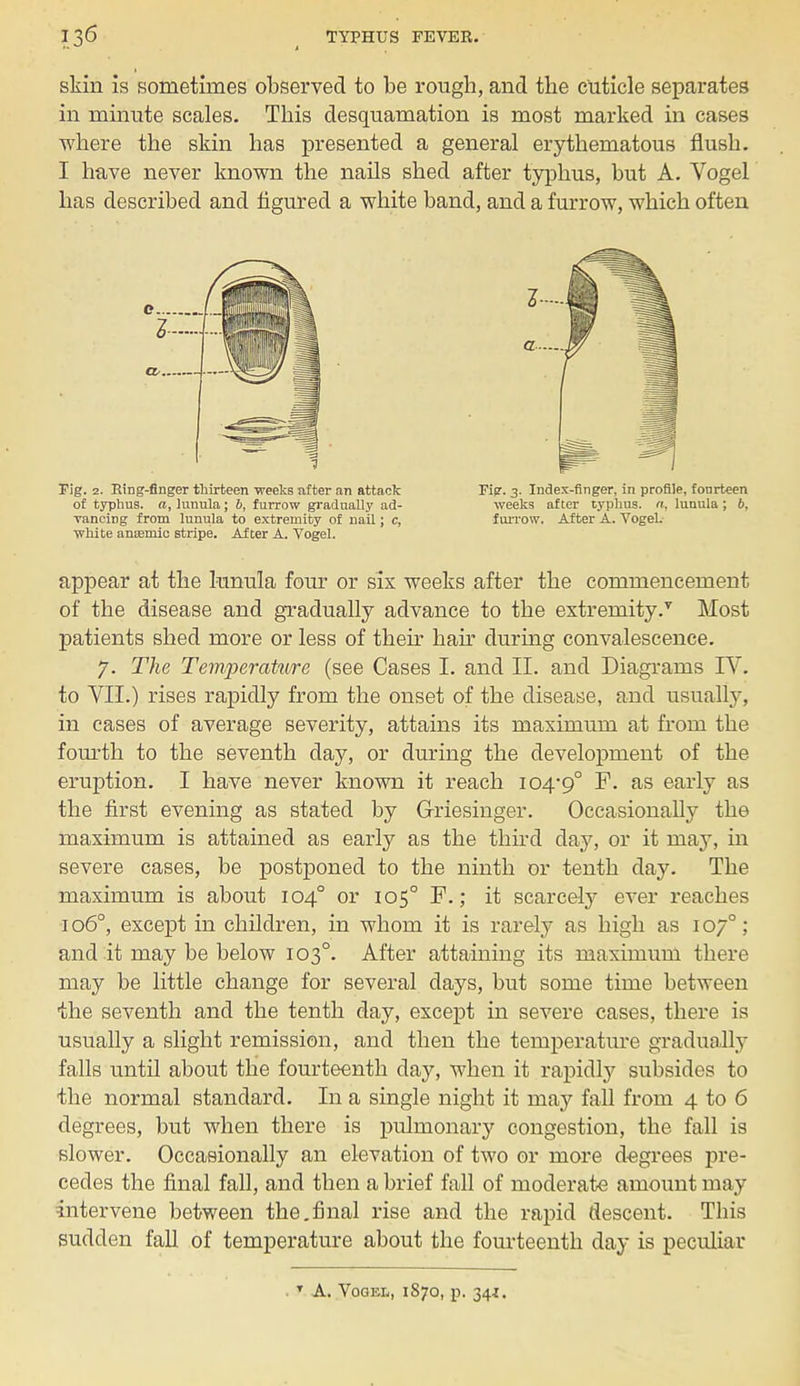 Tig. 2. Ring-finger thirteen weeks nfter an attack of typhus, a, lunula; 6, furrow gradually ad- vancing from lunula to extremity of nail; c, white ansemic stripe. After A. Vogel. Kg. 3. Index-finger, in profile, fourteen weeks after typhus, n, lunula; 6, furrow. After A. Vogel. skin is sometimes observed to be rough, and the Cuticle separates in minute scales. This desquamation is most marked in cases where the skin has presented a general erythematous flush. I have never known the nails shed after typhus, but A. Vogel has described and figured a white band, and a furrow, which often appear at the lunula four or six weeks after the commencement of the disease and gradually advance to the extremity/ Most patients shed more or less of their hair during convalescence. 7. The Temperature (see Cases I. and II. and Diagrams IV. to VII.) rises rapidly from the onset of the disease, and usually, in cases of average severity, attains its maximum at from the fourth to the seventh day, or during the development of the eruption. I have never known it reach 104-9° F. as early as the first evening as stated by G-riesinger. Occasionally the maximum is attained as early as the third day, or it may, in severe cases, be postponed to the ninth or tenth day. The maximum is about 104° or 105° F.; it scarcely ever reaches 106°, except in children, in whom it is rarely as high as 107°; and it may be below 103°. After attaining its maximum there may be little change for several days, but some time between the seventh and the tenth day, except in severe cases, there is usually a slight remission, and then the temperature gradually falls until about the fourteenth day, when it rapidly subsides to the normal standard. In a single night it may fall from 4 to 6 degrees, but when there is pulmonary congestion, the fall is slower. Occasionally an elevation of two or more degrees pre- cedes the final fall, and then a brief fall of moderate amount may intervene between the.final rise and the rapid descent. This sudden fall of temperature about the fourteenth day is peculiar T A. Yodel, 1S70, p. 34i.