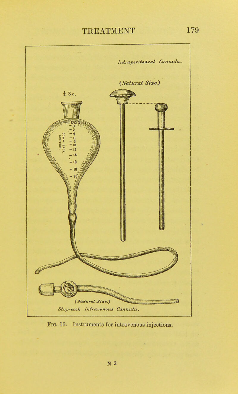 IniraperiioneaZ Canrutla. (Naiural Size.) Stop-cock iniravenovui Cannula, Fig. 16. Instruments for intravenous injections. N 2