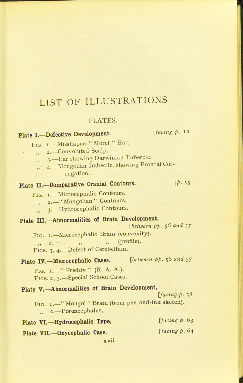 LIST OF ILLUSTRATIONS PLATES. Plate I—Defective Development. [facing p. 12 piG_ I.—Misshapen  Morel  Eax. 2. —Convoluted Scalp. 3. Ear showing Darwinian Tubercle. '[ 4. Mongolian Imbecile, showing Frontal Cor- rugation. Plate II.—Comparative Cranial Contours. [p- SS Fig. I.—Microcephalic Contours. 2. —Mongolian Contours. 3. —Hydrocephalic Contours. Plate III.—Abnormalities of Brain Development. [between pp. 56 and S7 Fig. I.—Microcephalic Brain (convexity). ,.2.— „ (profile). Figs. 3, 4.—Defect of Cerebellum, Plate IV.—Microcephalic Cases. [between pp. 56 and 57 Fig. I.— Freddy  (R. A. A.). Figs. 2, 3.—Special School Cases. Plate v.—Abnormalities of Brain Development. [facing p. 58 Fig. I.  Mongol  Brain (from pen-and-ink sketch). 2.—Porencephalus. Plate VI.—Hydrocephalic Type. [facing p. 63 Plate VII.—Oxycephalic Case. [facing p. 64