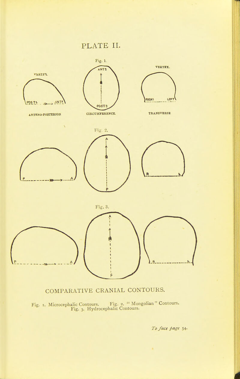Fig. 1. COMPARATIVE CRANIAL CONTOURS. Fig. I. Microcephalic Contours. Fig. 2.  Mongolian  Contours. Fig. 3. Hydrocephalic Contours.