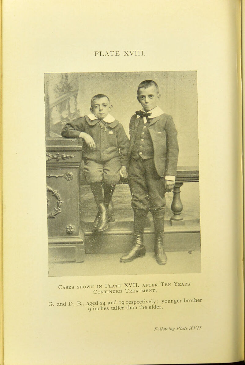 PLATE XVIII. Cases shown in Plate XVII. after Ten Years- Continued Treatment. G and D. B.. aged 24 and 19 respectively; younger brother 9 inches taller than the elder. Follo7vi>ig- Plate XVIr.