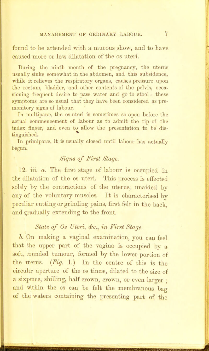 found to be attended with a mucous show, and to have caused more or less dilatation of the os uteri. During the ninth month of the pregnancy, the litems usually sinlcs somewhat in the abdomen, and this subsidence, while it reUeves the respiratory organs, causes pressure wpon the rectum, bladder, and other contents of the pelvis, occa- sioning frequent desire to pass water and go to stool: these symptoms are so usual that they have been considered as pre- monitory signs of labour. In multiparas, the os uteri is sometimes so open before the actual commencement of labour as to admit the tip of the index finger, and even to allow the presentation to be dis- tinguished. In primiparse, it is usually closed rmtU labour has actually begun. Signs of First Stage. 12. ili. a. The first stage of labour is occupied in the dilatation of the os uteri. This process is effected solely by the contractions of the uterus, unaided by any of the voluntaiy muscles. It is characterised by peculiar cutting or grinding jiains, first felt in the back, and gradually extending to the front. State of Os Uteri, <kc., in First Stage, h. On making a vaginal examination, you can feel that vhe upper part of the vagina is occupied by a soft, ?ounded tumour, formed by the lower portion of the vtenis. {Fig. 1.) In the centre of this is the circulir aperture of the os tincse, dilated to the size of a sixpmce, shilling, half-crown, crown, or even larger ; and -within the os can be felt the membranous bag of the waters containing the presenting part of the