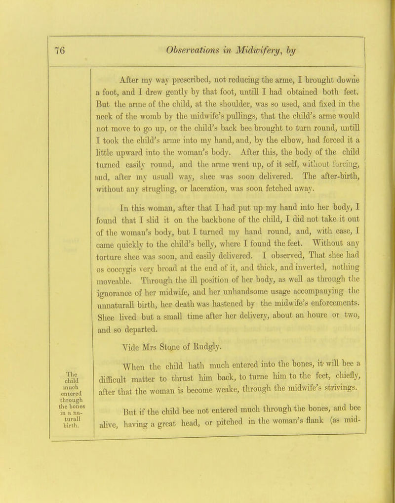 The child much piiiered through the bones in a na- turall birth. After my way prescribed, not reducing the arme, I brought downe a foot, and 1 drew gently by that foot, untUl I had obtained both feet. But the arine of the child, at the shoulder, was so used, and fixed in the neck of the womb by the midwife's pullings, that the child's arme would not move to go up, or the child's back bee brought to turn round, untiU I took the child's arme into my hand, and, by the elbow, had forced it a little upward into the woman's body. After this, the body of the child turned easily round, and the arme went up, of it seK, without forcing, and, after my usuall way, shee was soon delivered. The after-birth, without any strugling, or laceration, was soon fetched away. In this woman, after that I had put up my hand into her body, I found that I slid it on the backbone of the cliild, I did not take it out of tlie woman's body, but I turned my hand round, and, with ease, I came quickly to the child's belly, wliere I found the feet. Without any torture shee was soon, and easily dehvered. I observed, Tliat shee had OS coccygis very broad at the end of it, and tliick, and inveited, nothing moveable. Through the ill position of her body, as well as tiu'ough the ignorance of her midwife, and her unhandsome usage accompanying the unnaturaU bhth, her death was hastened by the midwife's enforcements. Shee hved but a small tune after her delivery, about an hom-e or two, and so depaaied. Vide Mrs Stone of Rudgly. When the cliild hath much entered into the bones, it-will bee a difficult matter to thi-ust lihn back, to tiu-ne liim to the feet, cliiefly, after that the woman is become weake, tln-ough the midwife's strivings. But if the child bee not entered much through the bones, and bee alive, having a great head, or pitched in the woman's flank (as mid-