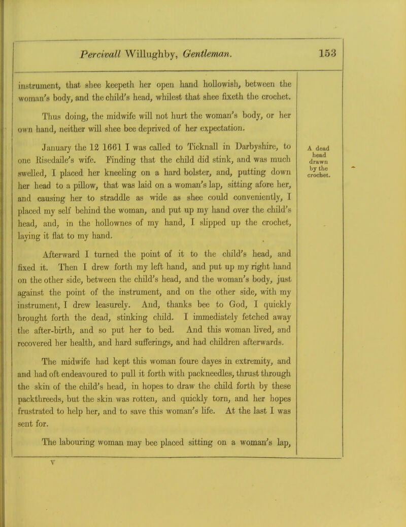 instrument, that hIicc keepeth her open hand hoilowisJi, between the woinun'.s body, and thochihr.s head, whilest that shee fixeth the eroehet. TliuH doing, the midwife will not hurt the woman's body, or her own liand, neither wUl sliee bee deprived of her expectation. January the 12 1661 I was called to Ticknall in Darbyshire, to a dead one Kisedaile's wife. Finding that the child did stink, and was much swelled, I placed her kneebng on a hard bolster, and, putting down crochet, her head to a piUow, that was laid on a woman's lap, sitting afore her, and causing her to straddle as wide as shee could converu'ently, I placed my sell' behind the woman, and put up my hand over the child's head, and, in the hollownes of my hand, I slipped up the crochet, laying it flat to my hand. iUterward I turned the point of it to the child's head, and fixed it. ITien I drew forth my left liand, and put up my right hand on the other side, between the child's head, and the woman's body, just agaiiLst the point of the instrument, and on the other side, with my instrument, T drew leasurely. And, thanks bee to God, I quickly brought forth the dead, stinking child. I immediately fetched away the after-birth, and so put her to bed. And this woman Uved, and recovered her health, and hard sufferings, and had children afterwards. The midwife had kept this woman foure dayes in extremity, and and had oft endeavoured to pull it forth with packneedles, thrust through the skin of the child's head, in hopes to draw the child forth by these packthreeds, but the skin was rotten, and quickly torn, and her hopes frustrated to help her, and to save this woman's Ufe. At the last I was sent for. The labouring woman may bee placed sitting on a woman's lap.