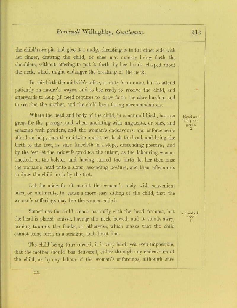 the child's armpit^ aud give it a nudg, thrusting it to the other side with her foigePj di-awing the child, or shea may quickly bring forth the shoulders, without offering to put it forth by her hands clasped about the neck, which might endanger the breaking of the neck. In this birth the midwife's ofl&ce, or duty is no more, but to attend patiently on nature's wayes, and to bee ready to receive the cliild, and afterwards to help (if need require) to draw forth the after-bui'den, and to see that the mother, and the child have fitting accommodations. Where the head and body of the child, in a naturall birth, bee too great for the passage, and when anointing with unguents, or oiles, and sneezing with powders, and the woman's endeavours, and enforcements afford no help, then the midwife must turn back the head, and bring the birth to the feet, as shee kneeleth in a slope, descending posture; and by the feet let the midwife produce the infant, as the labouiing woman kneeleth on the bolster, and having turned the birth, let her then raise the woman's head unto a slope, ascending posture, and then afterwards to draw the child forth by the feet. Let the midwife oft anoint the woman's body with convenient oiles, or ointments, to cause a more easy sliding of the child, that the woman's sufferings may bee the sooner ended. Sometimes the cliild comes naturally with the head formost, but the head is placed amisse, having the neck bowed, and it stands awry, leaTiing towards the flanks, or otherwise, which makes that the child cannot come forth in a straight, and direct line. The child being thus turned, it is very hard, yea even impossible, that the mother should bee delivered, either through any endeavours of the child, or by any labour of the woman's enforcings, although shee Head autl bodj loo great. 2. A crooked neck. 3.