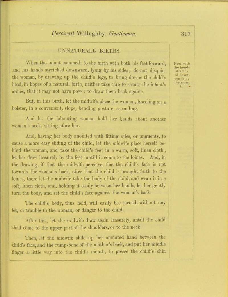 UNNATURALL BIRTHS. ■ ! \ When the infant corameth to the birth with both liis feet forward, i Kcet with I j and his hands stretched downward, lying by his sides; do not disquiet stretch- i the woman, by drawing up the child's legs, to bring downe the child's ' wlrliTby' I ; head, in hopes of a naturall birth, neither take care to secure the infant's I j I I I armes, that it may not have power to draw them back againe. j i I But, in this birth, let the midwife place the woman, kneeling on a I bolster, in a convem'ent, slope, bending posture, ascending. i And let the labouring woman hold her hands about another , woman's neck, sitting afore her. i I And, having her body anointed with fitting oiles, or unguents, to cause a more easy sliding of the child, let the midwife place herself be- ; hind the woman, and take the child's feet in a warm, soft, linen cloth; let her draw leasurely by the feet, untill it come to the loines. And, in j the drawing, if that the midwife perceive, that the child's face is not • towards the woman's back, after that the child is brought forth to the loines, there let the midwife take the body of the cliild, and wrap it in a soft, linen cloth, and, holding it easily between her hands, let her gently ! turn the body, and set the child's face against the woman's back. The child's body, thus held, will easily bee turned, without any let, or trouble to the woman, or danger to the child. j j After this, let the midwife draw again leasurely, untill the child j I shall come to the upper part of the shoulders, or to the neck. { I Then, let the midwife slide up her anointed hand between the ' child's face, and the rump-bone of the mother's back, and put her middle I finger a little way into th.e child's mouth, to presse the child's chin