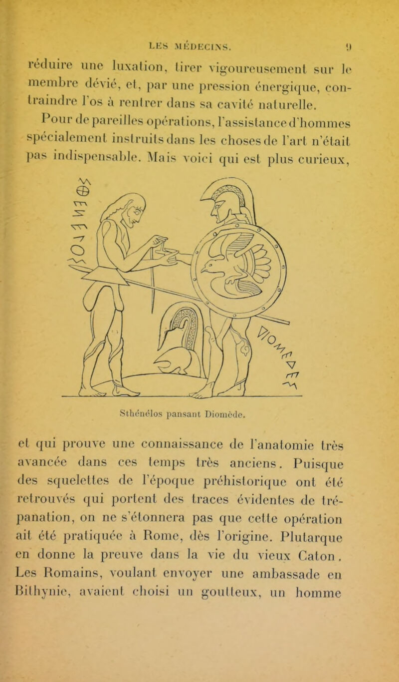 réduiro uno luxation, lirer vigoiirouscmenl sur )<• membre dévié, el, par une pression énergique, con- traindre los à rentrer dans sa cavité naturelle. Pour de pareilles opérations, lassistance d'hommes spécialement instruits dans les choses de larl n'était pas indispensable. Mais voici qui est plus curieux. Sihcnolo.s pansant Dionicde. et qui prouve une connaissance de l'analomie très avancée dans ces temps très anciens. Puisque des squelettes de l'époque préhistorique ont été retrouvés qui portent des traces évidentes de tré- panation, on ne s'étonnera pas que cette opération ail été pratiquée à Rome, dès l'origine. Plutarque en donne la preuve dans la vie du vieux Caton . Les Romains, voulant envoyer une ambassade en Rithynie, avaient choisi un goutteux, un homme