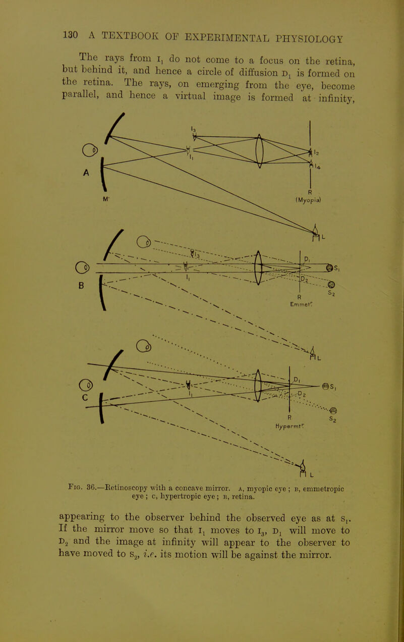 The rays from I, do not come to a focus on the retina, but behind it, and hence a circle of diffusion dx is formed on the retina. The rays, on emerging from the eye, become parallel, and hence a virtual image is formed at infinity, Fig. 36.—Retinoscopy with a concave mirror, a, myopic eye ; b, emmetropic eye ; c, hypertropic eye ; n, retina. appearing to the observer behind the observed eye as at s,. If the mirror move so that ix moves to i3, Dl will move to D2 and the image at infinity will appear to the observer to have moved to s2, i.e. its motion will be against the mirror.