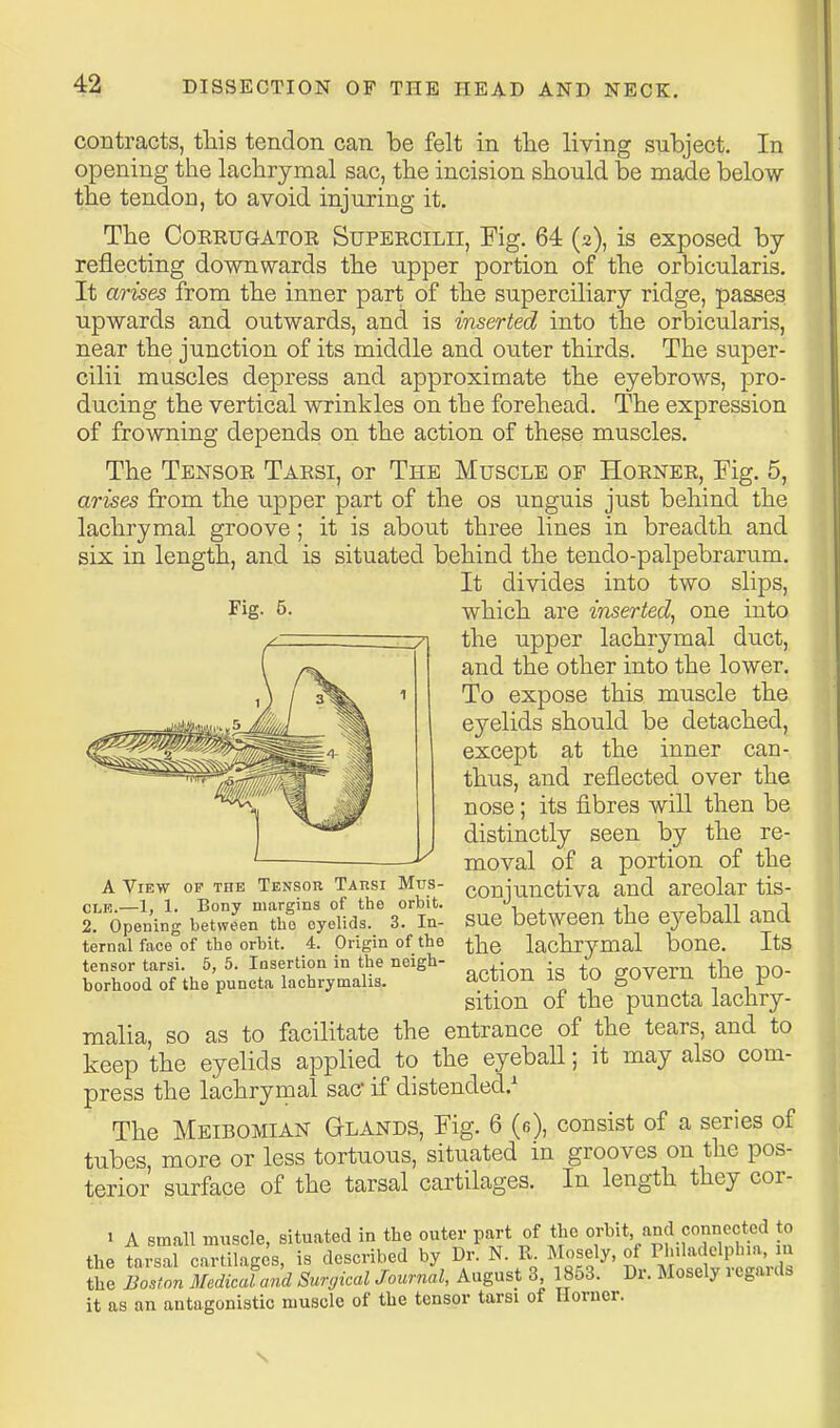 contracts, tliis tendon can be felt in the living subject. In opening the lachrymal sac, the incision should be made below the tendon, to avoid injuring it. The CoEEUGATOR SuPEECiLii, Eig. 64 (2), is exposed by reflecting downwards the upper portion of the orbicularis. It arises from the inner part of the superciliary ridge, passes upwards and outwards, and is inserted into the orbicularis, near the junction of its middle and outer thirds. The super- cilii muscles depress and approximate the eyebrows, pro- ducing the vertical wrinkles on the forehead. The expression of frowning depends on the action of these muscles. The Tensoe Taesi, or The Muscle of Hoenee, Fig. 5, arises from the upper part of the os unguis just behind the lachrymal groove; it is about three lines in breadth and six in length, and is situated behind the tendo-palpebrarum. It divides into two slips, Fig. 5. which are inserted, one into the upper lachrymal duct, and the other into the lower. To expose this muscle the eyelids should be detached, except at the inner can- thus, and reflected over the nose; its fibres will then be distinctly seen by the re- moval of a portion of the conjunctiva and areolar tis- sue between the eyeball and the lachrymal bone. Its action is to govern the po- sition of the puncta lachry- malia, so as to facilitate the entrance of the tears, and to keep the eyelids applied to the eyeball; it may also com- press the lachryroal sac if distended.^ The Meibomian Glands, Fig. 6 (e), consist of a series of tubes more or less tortuous, situated in grooves on the pos- terior surface of the tarsal cartilages. In length they cor- 1 A small muscle, situated in the outer part of the orbit and connected to the tarsal cartilages, is described by Dr. N. E. Mosely. of Philadelphia, m the Iston Medical and Surgical Journal, August 3 1853. Dr. Mosely regards it as an antagonistic muscle of the tensor tarsi of Horner. A View op the Tensor Tarsi Mus- CLK.—1, 1. Bony margins of the orbit. 2. Opening between the eyelids. 3. In- ternal face of the orbit. 4. Origin of the tensor tarsi. 5, 5. Insertion in the neigh- borhood of the puncta laohrymalis. s