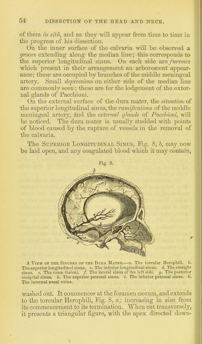 54- of fhem in situ, and as they will appear from time to time in tlie progress of his dissection. On the inner surface of the calvaria will be observed a groove extending along the median line; this corresponds to the superior longitudinal sinus. On each side axefurroius which present in their arrangement an arborescent appear- ance; these are occupied by branches of the middle meningeal artery. Small depressions on either side of the median line are commonly seen; these are for the lodgement of the exter- nal glands of Pacchioni. On the external surface of the dura mater, the situation of the superior longitudinal sinus, the ramifications of the middle meningeal artery, and the external glands of Pacchioni, will be noticed. The dura mater is usually studded with points of blood caused by the rupture of vessels in the removal of the calvaria. The SuPEEioE Longitudinal Sinus, Fig. 8, b, may now be laid open, and any coagulated blood which it may contain, Fig. 8. A View op the Sinuses op the Dura Mateu.—a. The torcular Ilerophili. h. The superior longitudinal sinus, c. The inferior longitudinal sinus, d. The straight sinus, e. The venae Galeni. /. The Lateral sinus of the left side. g. The posterior occipital sinus, h. The superior petrosal sinus, i. The inferior petrosal sinus, k. The internal nasal veins. washed out. It commences at the foramen caecum, and extends to the torcular Herophili, Fig. 8, a; increasing in size from its commencement to its termination. When cut transversely, it presents a triangular figure, with the apex directed down-