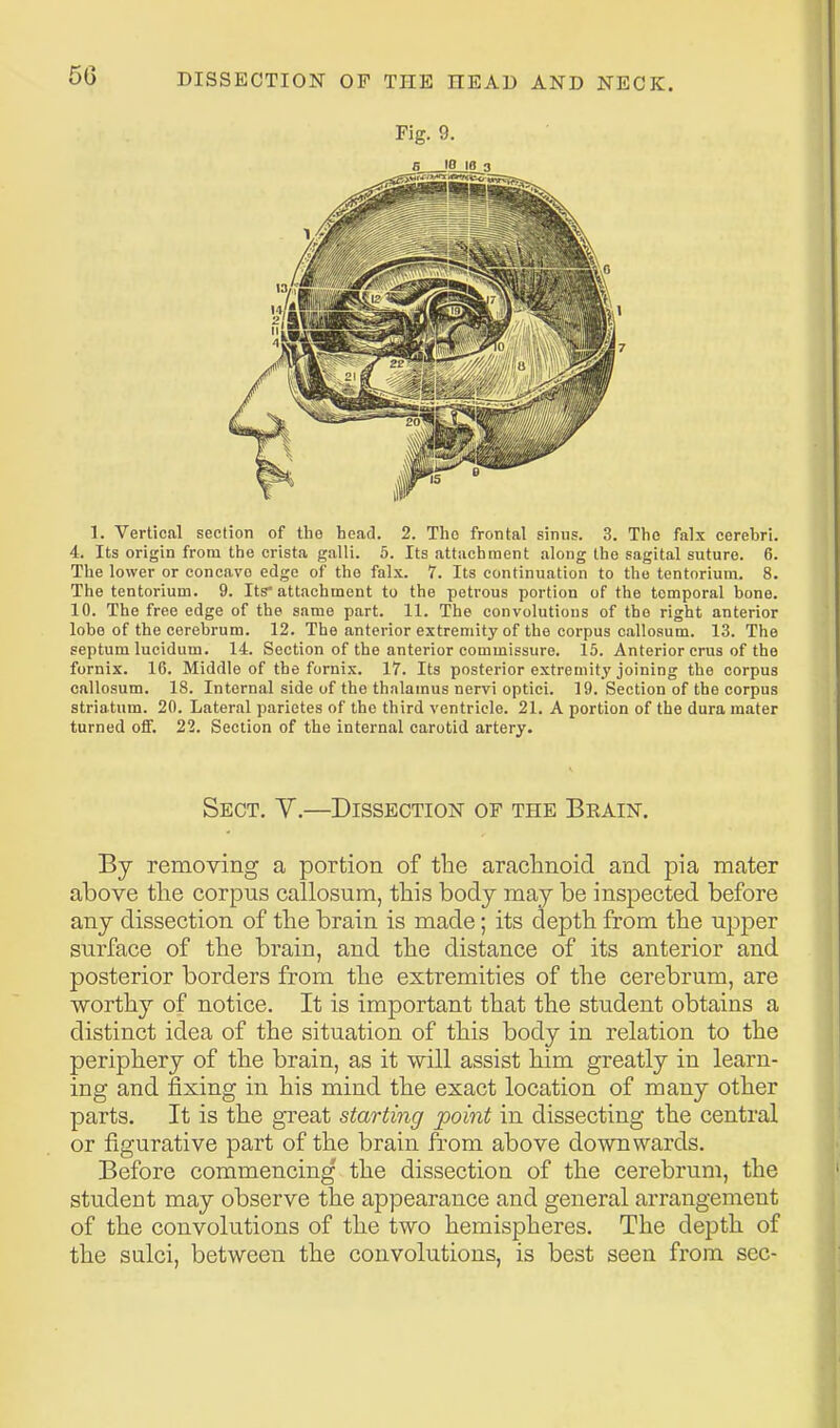 Fig. 9. 5 lOjB 3 1. Vertical section of the head. 2. The frontal sinns. 3. Tlie falx cerebri. 4. Its origin from the crista galli. 5. Its attachment along the sagital suture. 6. The lower or concave edge of the falx. 7. Its continuation to the tentorium. 8. The tentorium. 9. Its'attachment to the petrous portion of the temporal bone. 10. The free edge of the same part. 11. The convolutions of the right anterior lobe of the cerebrum. 12. The anterior extremity of the corpus callosum. 13. The septum lucidum. 14. Section of the anterior commissure. 15. Anterior crus of the fornix. 16. Middle of the fornix. 17. Its posterior extremity joining the corpus callosum. 18. Internal side of the thalamus nervi optiei. 19. Section of the corpus striatum. 20. Lateral parietes of the third ventricle. 21. A portion of the dura mater turned off. 22. Section of the internal carotid artery. Sect. V.—Dissection of the Brain. By removing a portion of the arachnoid and pia mater above the corpus callosum, this body may be inspected before any dissection of the brain is made; its depth from the upper surface of the brain, and the distance of its anterior and posterior borders from the extremities of the cerebrum, are worthy of notice. It is important that the student obtains a distinct idea of the situation of this body in relation to the periphery of the brain, as it will assist him greatly in learn- ing and fixing in his mind the exact location of many other parts. It is the gTeat starting point in dissecting the central or figurative part of the brain from above downwards. Before commencing the dissection of the cerebrum, the student may observe the appearance and general arrangement of the convolutions of the two hemispheres. The depth of the sulci, between the convolutions, is best seen from sec-