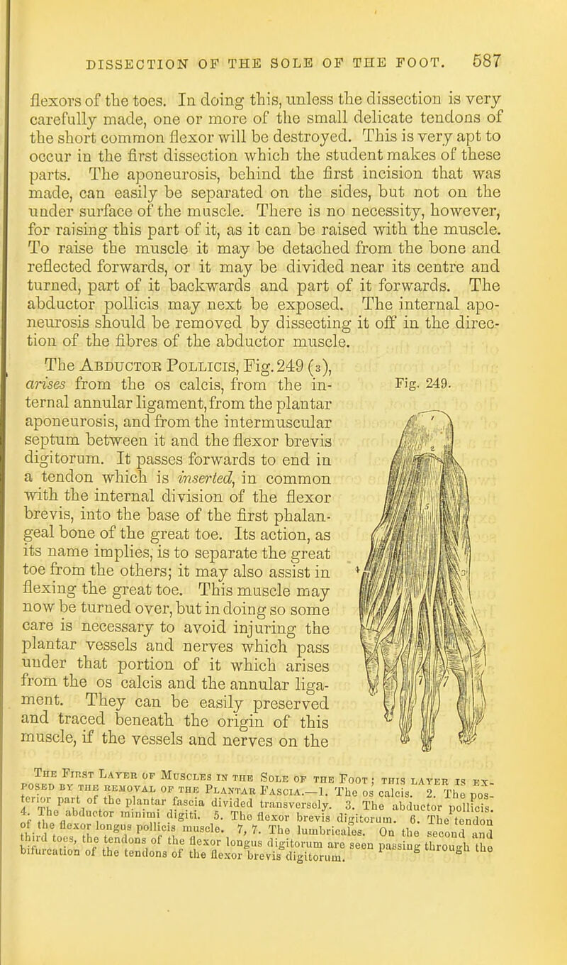 Fig. 249. flexors of the toes. In doing this, unless the dissection is very carefully made, one or more of the small delicate tendons of the short common flexor will be destroyed. This is very apt to occur in the first dissection which the student makes of these parts. The aponeurosis, behind the first incision that was made, can easily be separated on the sides, but not on the tinder surface of the muscle. There is no necessity, however, for raising this part of it, as it can be raised with the muscle. To raise the muscle it may be detached from the bone and reflected forwards, or it may be divided near its centre and turned, part of it backwards and part of it forwards. The abductor pollicis may next be exposed. The internal apo- neurosis should be removed by dissecting it off in the direc- tion of the fibres of the abductor muscle. The Abductor Pollicis, Fig. 249 (3), arises from the os calcis, from the in- ternal annular ligament, from the plantar aponeurosis, and from the intermuscular septum between it and the flexor brevis digitorum. It passes forwards to end in a tendon which is inserted, in common with the internal division of the flexor brevis, into the base of the first phalan- geal bone of the great toe. Its action, as its name implies, is to separate the great toe from the others; it may also assist in flexing the great toe. This muscle may now be turned over, but in doing so some care is necessary to avoid injuring the plantar vessels and nerves which pass under that portion of it which arises from the os calcis and the annular liga- ment. They can be easily preserved and traced beneath the origin of this muscle, if the vessels and nerves on the „ Muscles in the Sole of the Foot ; this layer is ex- POSED BY THE REMOVAL OF THE Plantar Fascia.-1. The OS calcis. 2. The poi tcrior part of the plantar fascia divided transversely. 3. The abductor polHeis 4 The abductor minimi digiti. 6. The flexor brevis digitorum. 6 The tondTa of the flexor longus poll eis muscle. 7,7. The lumbricales. On the second and th.rd toes, the tendons of the flexor longus digitorum are seen pass ug thiwh the bifurcation of the tendons of the fle.xor brevis digitorum ^ tuiougu the