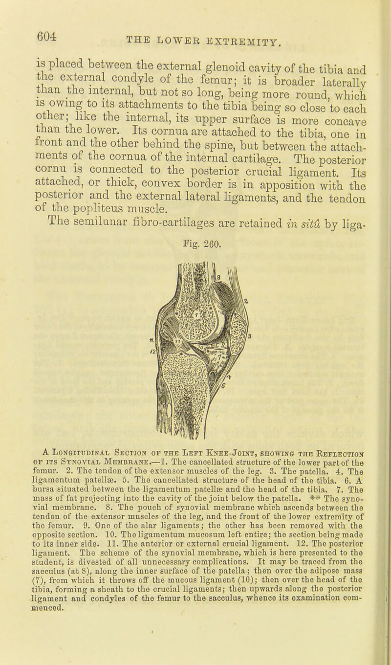 IS placed between the external glenoid cavity of tlie tibia and tie external condyle of the femur; it is broader laterally than the internal, but not so long, being more round, which IS owing to Its attachments to the tibia being so close to each other; like the internal, its upper surface is more concave than the lower. Its cornua are attached to the tibia, one in front and the other behind the spine, but between the attach- ments of the cornua of the internal cartilage. The posterior cornu is connected to the posterior crucial ligament. Its attached, or thick, convex border is in apposition with the posterior and the external lateral ligaments, and the tendon of the poj)liteus muscle. The semilunar fibro-cartilages are retained m situ by liga- Fig. 260. A Longitudinal Section of the Left Knee-Joint, showing the Reflection OF ITS Synovial Membrane.—1. Tho cancellated structure of the lower partof the fomur. 2. The tendon of the extensor muscles of tho leg. 3. The patella. 4. The ligamentum patellaj. 5. Tho cancellated structure of the head of the tibia. 6. A bursa situated between the ligamentum patellas and the head of the tibia. 7. The mass of fat projecting into the cavity of the joint below the patella. ** The syno- vial membrane. 8. The pouch of synovial membrane which ascends between the tendon of the extensor muscles of the leg, .and the front of the lower extremity of the femur. 9. One of the alar ligaments; the other has been removed with the opposite section. 10. The ligamentum mucosum left entire; the section being made to its inner sido. 11. The anterior or external crucial ligament. 12. The posterior ligament. The scheme of the synovial membrane, which is here presented to the student, is divested of all unnecessary complications. It may be traced from the saoculus (at S), along the inner surface of the patella; then over the adipose mass (7), from which it throws off tho mucous ligament (10); then over the head of tho tibia, forming a sheath to the crucial ligaments; then upwards along the posterior ligament and condyles of the femur to the sacculus, whence its examination com- menced.