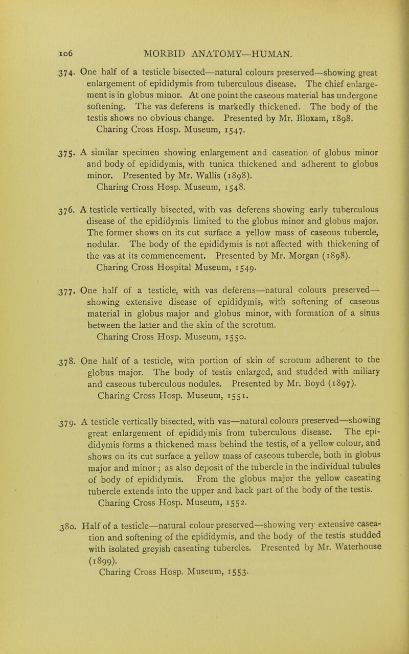 374. One half of a testicle bisected—natural colours preserved—showing great enlargement of epididymis from tuberculous disease. The chief enlarge- ment is in globus minor. At one point the caseous material has undergone softening. The vas deferens is markedly thickened. The body of the testis shows no obvious change. Presented by Mr. Bloxam, 1898. Charing Cross Hosp. Museum, 1547. ,375. A similar specimen showing enlargement and caseation of globus minor and body of epididymis, with tunica thickened and adherent to globus minor. Presented by Mr. Wallis (1898). Charing Cross Hosp. Museum, 1548. 376. A testicle vertically bisected, with vas deferens showing early tuberculous disease of the epididymis limited to the globus minor and globus major. The former shows on its cut surface a yellow mass of caseous tubercle, nodular. The body of the epididymis is not affected with thickening of the vas at its commencement. Presented by Mr. Morgan (1898). Charing Cross Hospital Museum, 1549. 377. One half of a testicle, with vas deferens—natural colours preserved— showing extensive disease of epididymis, with softening of caseous material in globus major and globus minor, with formation of a sinus between the latter and the skin of the scrotum. Charing Cross Hosp. Museum, 1550. 378. One half of a testicle, with portion of skin of scrotum adherent to the globus major. The body of testis enlarged, and studded with miliary and caseous tuberculous nodules. Presented by Mr. Boyd (1897). Charing Cross Hosp. Museum, 1551. 379. A testicle vertically bisected, with vas—natural colours preserved—showing great enlargement of epididymis from tuberculous disease. The epi- didymis forms a thickened mass behind the testis, of a yellow colour, and shows on its cut surface a yellow mass of caseous tubercle, both in globus major and minor; as also deposit of the tubercle in the individual tubules of body of epididymis. From the globus major the yellow caseating tubercle extends into the upper and back part of the body of the testis. Charing Cross Hosp. Museum, 1552. 380. Half of a testicle—natural colour preserved—showing very extensive casea- tion and softening of the epididymis, and the body of the testis studded with isolated greyish caseating tubercles. Presented by Mr. Waterhouse (1899). Charing Cross Hosp. Museum, 1553.