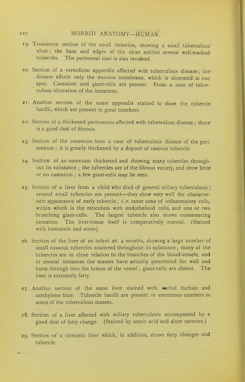19. Transverse section of the small intestine, showing a smali tuberculous ulcer; the base and edges of the ulcer exhibit several well-marked' tubercles. The peritoneal coat is also involved. 20. Section of a vermiform appendix affected with tuberculous disease; th<T disease affects only the mucous membrane, which is ulcerated at one spot. Caseation and giant-cells are present. From a case of tuber- culous ulceration of the intestines. 21. Another section of the same appendix stained to show the tubercle bacilli, which are present in great numbers. 22. Section of a thickened peritoneum affected with tuberculous disease ; there is a good deal of fibrosis. 23. Section of the omentum from a case of tuberculous disease of the peri- toneum ; it is greatly thickened by a deposit of caseous tubercle. 24. Section of an omentum thickened and showing many tubercles through- out its substance; the tubercles are of the fibrous variety, and show little-' or no caseation; a few giant-cells may be seen. 25. Section of a liver from a child who died of general miliary tuberculosis ' several small tubercles are present—they show very well the character- istic appearance of early tubercle; i. e. outer zone of inflammatory cells, within which is the reticulum with endothelioid cells, and one or two branching giant-cells. The largest tubercle also shows commencing caseation. The liver-tissue itself is comparatively normal. (Stained with hajmatein and eosin). 26. Section of the liver of an infant set. 4 months, showing a large number of small caseous tubercles scattered throughout its substance; many of the tubercles are in close relation to the branches of the blood-vessels, and in several instances the masses have actually penetrated the wall and burst through into the lumen of the vessel; giant-cells are absent. The liver is extremely fatty. 27. Another section of the same liver stained with eerbol fuchsin and methylene blue. Tubercle bacilli are present in enormous numbers in some of the tuberculous masses. 28. Section of a liver affected with miliary tuberculosis accompanied by a good deal of fatty change. (Stained by osrnic acid and alum carmine.) 39. Section of a cirrhotic liver which, in addition, shows fatty changes and tubercle.