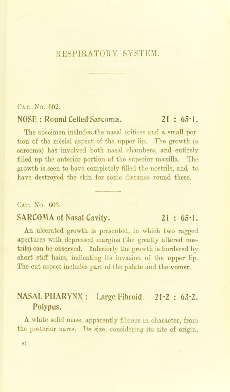 Cat. No. G02. NOSE : Round Celled Sarcoma. 21 : 65*1. The specimen includes the nasal orifices and a small por- tion of the mesial aspect of the upper lip. The growth (a sarcoma) has involved both nasal chambers, and entirely filled up the anterior portion of the superior maxilla. The growth is seen to have completely filled the nostrils, and to have destroyed the skin for some distance round these. Cat. No. 603. SARCOMA Of Nasal Cavity. 21 : 65-1. An xilcerated gi'owth is presented, in which two ragged apertures with depressed margins (the greatly altered nos- trils) can be observed. Inferiorly the growth is bordered by short stiff hairs, indicating its invasion of the upper lip. The cut aspect includes part of the palate and the vomer. NASAL PHARYNX : Large Fibroid 21-2 : 63-2. Polypus. A white soUd mass, apparently fibrous in character, from the posterior nares. Its size, considering its site of origin.