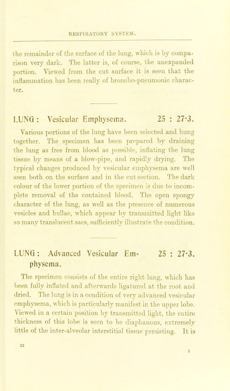 the remainder of the surface of the lung, which is by compa- rison very dark. The latter is, of course, the unexpanded portion. Viewed from the cut surface it is seen that the inflammation has been really of broncho-pneimionic charac- ter. I.UNG : Vesicular Emphysema. 25 : 27-3. Various portions of the lung have been selected and hung together. The specimen has been prepared by draining the lung as free from blood as possible, inflating the hmg tissue by means of a blow-pipe, and rapidly drying. The typical changes produced by vesicular emphysema are well seen both on the stu-face and in the cut section. The dark colour of the lower portioii of the specimen is due to incom- plete removal of the contained blood. The open spongy character of the lung, as well as the presence of numerous vesicles and bullae, which appear by transmitted light hke so many translucent sacs, sufficiently illustrate the condition. LUNG : Advanced Vesicular Em= 25 : 27-3. physema. The specimen consists of the entire right lung, which has been fully inflated and afterwards ligatured at the root and dried. The lung is in a condition of very adA'anced vesicular emphysema, which is particularly manifest in the upper lobe. Viewed in a certain position by transmitted light, the entire thickness of this lobe is seen to be diaphanous, extremely little of the inter-alveolar interstitial tissue persisting. It is 33 3