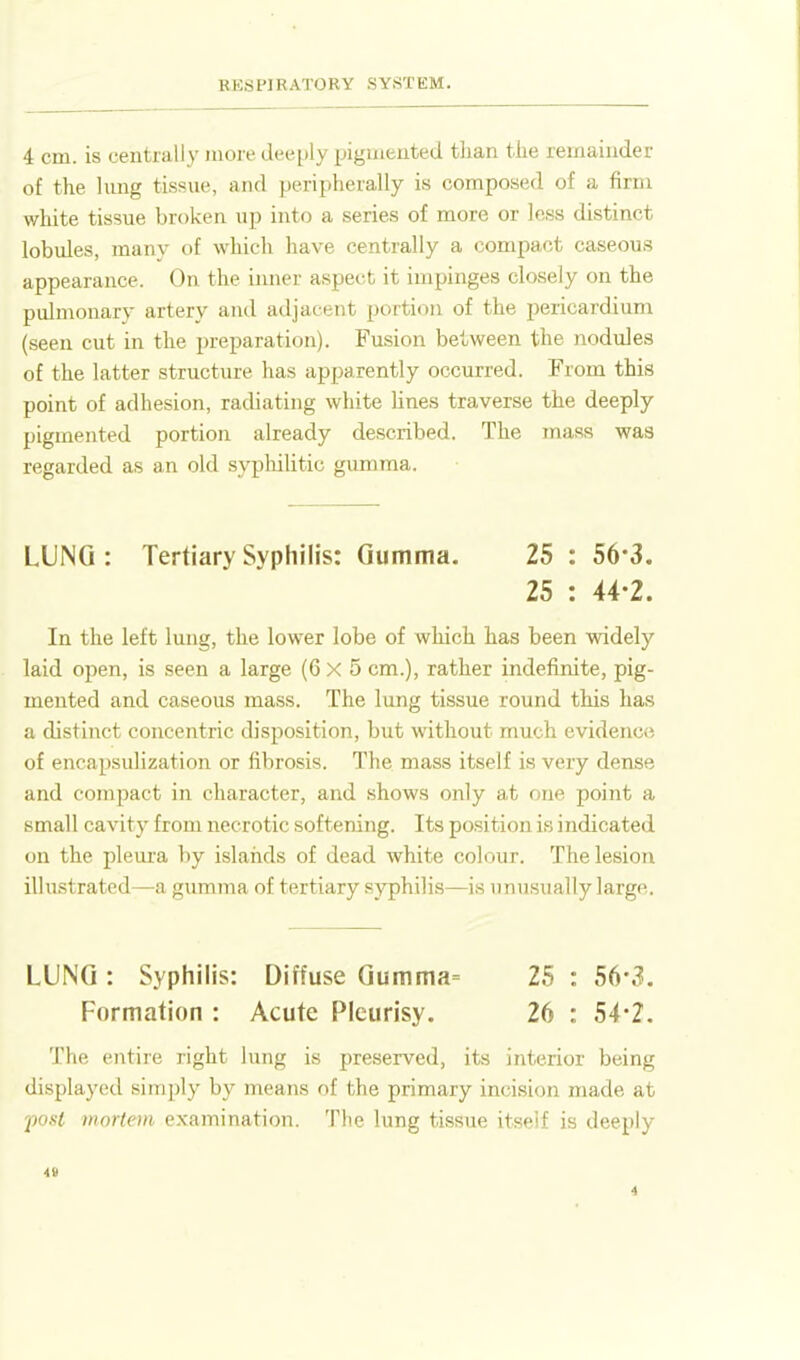 4 cm. is centrally moi e cUx-ply pigiuented than the remainder of the hmg tissue, and peripherally is composed of a firm white tissue broken up into a series of more or less distinct lobules, many of which have centrally a compact caseous appearance. On the inner aspect it impinges closely on the pulmonary artery and adjacent portion of the pericardium (seen cut in the preparation). Fusion between the nodules of the latter structure has apparently occurred. From this point of adhesion, radiating white hnes traverse the deeply pigmented portion already described. The mass was regarded as an old syphilitic gumma. LUNG: Tertiary Syphilis: Gumma. 25 : 56*3. 25 : 44-2. In the left lung, the lower lobe of which has been widely laid open, is seen a large (6x5 cm.), rather indefinite, pig- mented and caseous mass. The lung tissue round this has a distinct concentric disposition, but without much evidence of encapsulization or fibrosis. The mass itself is very dense and compact in character, and .shows only at one point a small cavity from necrotic softening. Its position is indicated on the pleura by islands of dead white colour. The lesion illustrated—a gumma of tertiary syphilis—is imusually large. LUNG : Syphilis: Diffuse Gumma= 25 : 56'3. Formation : Acute Pleurisy. 26 : 54*2, The entire right lung is preserved, its interior being displayed simply by means of the primary incision made at 'post niortoii examination. The lung tissue itseif is deeply