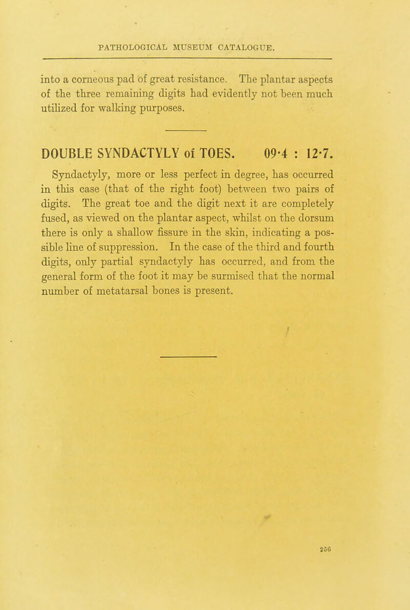 into a corneous pad of great resistance. The plantar aspects of tlie three remaining digits had evidently not been much utiUzed for walking purposes. DOUBLE SYNDACTYLY of TOES. 09-4 : 12-7. Syndactyly, more or less perfect in degree, has occurred in this case (that of the right foot) between two pairs of digits. The great toe and the digit next it are completely fused, as viewed on the plantar aspect, whilst on the dorsum there is only a shallow fissure in the skin, indicating a pos- sible line of suppression. In the case of the third and fourth digits, only partial syndactyly has occurred, and from the general form of the foot it may be surmised that the normal number of metatarsal bones is present. 366
