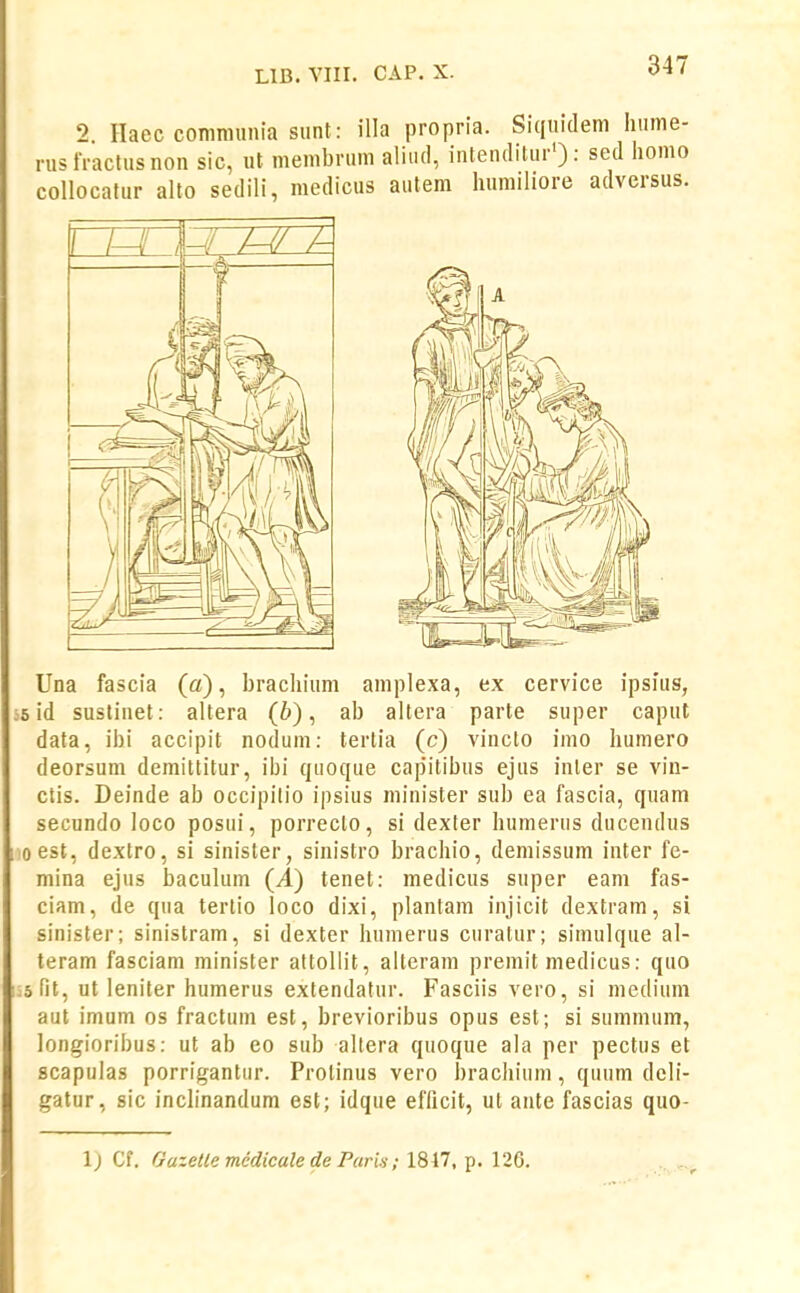 2 Haec communia siint: illa propria. Siquidem hume- nisfraclusnon sic, «t membrum aliiul, iulenditur') : sed homo collocatur alto sedili, medicus autem humiiiore adversus. Una fascia (a), brachium amplexa, ex cervice ipsius, i6 id sustinet: altera (6), ab altera parte super caput data, ibi accipit nodum: tertia (c) vincto imo humero deorsum demittitur, ibi quoque capitibus ejus inler se vin- ctis. Deinde ab occipitio ipsius niinister sub ea fascia, quam secundo loco posui, porrecto, si dexfer humerus ducendus oest, dextro, si sinister, sinistro brachio, demissum inter fe- mina ejus baculum (^) tenet: medicus super eam fas- ciam, de qua tertio loco dixi, plantam injicit dextram, si sinister; sinistram, si dexter humerus curatur; simulque al- teram fasciam minister attollit, alteram premit medicus: quo .sfit, ut leniter humerus extendatur. Fasciis vero, si medium aut imum os fractum est, brevioribus opus est; si summum, longioribus: ut ab eo sub altera quoque ala per pectus et scapulas porrigantur. Protinus vero bracliium, quum deli- gatur, sic inchnandum est; idque efflcit, ut ante fascias quo- l) Cf. Gazetle medicale de Paris; 1847, p. 126.