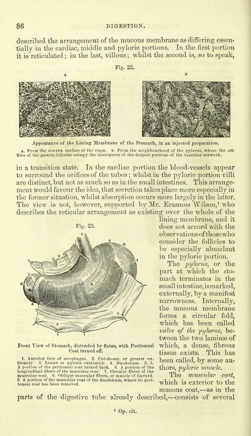 described the arrangement of the mucous membrane as differing essen- tially in the cardiac, middle and pyloric portions. In the first portion it is reticulated; in the last, villous; whilst the second is, so to speak, Fig. 22. Appearance of the Lining Membrane of the Stomach, in an injected preparation. A. From the convex surface of the rugje. B. From the neighbourhood of the pylorus, where the ori- fices of the gastric follicles occupy the interspaces of the deepest portions of the vascular network. in a transition state. In the cardiac portion the blood-vessels appear to surround the orifices of the tubes ; whilst in the pyloric portion villi are distinct, but not as much so as in the small intestines. This arrange- ment would favour the idea, that secretion takes place more especially in the former situation, whilst absorption occurs more largely in the latter. The view is not, however, supported by Mr. Erasmus Wilson,' who describes the reticular arrangement as existing over the whole of the lining membrane, and it Fig. 23. does not accord with the observations of those who consider the follicles to be especially abundant in the pyloric portion. The joylorus, or the part at which the sto- mach terminates in the small intestine,ismarked, externally, by a manifest narrowness. Internally, the mucous membrane forms a circular fold, which has been called valve of the pylorus, be- tween the two laminae of which, a dense, fibrous tissue exists. This has been called, by some au- thors, pyloric muscle. The muscular coat, which is exterior to the mucous coat,—as in the parts of the digestive tube already described,—consists of several Pront View of Stomach, distended by flatus, with Peritoneal Coat turned off. 1. Anterior face of oesophagus. 2. Cul-de-sac, or greater ex- tremity. 3. Lesser or pyloric extremity. 4. Duodenum, .'i, 5. A portion of the peritoneal coat turned back. 6. A portion of the longitudinal fibres of the muscular coat. 7. Circular fibres of the muscular coat. 8. Oblique muscular fibres, or muscle of Gavard. 9. A portion of the muscular coat of the duodenum, where its pei'i- toneal coat has been removed. ' Op. cit.