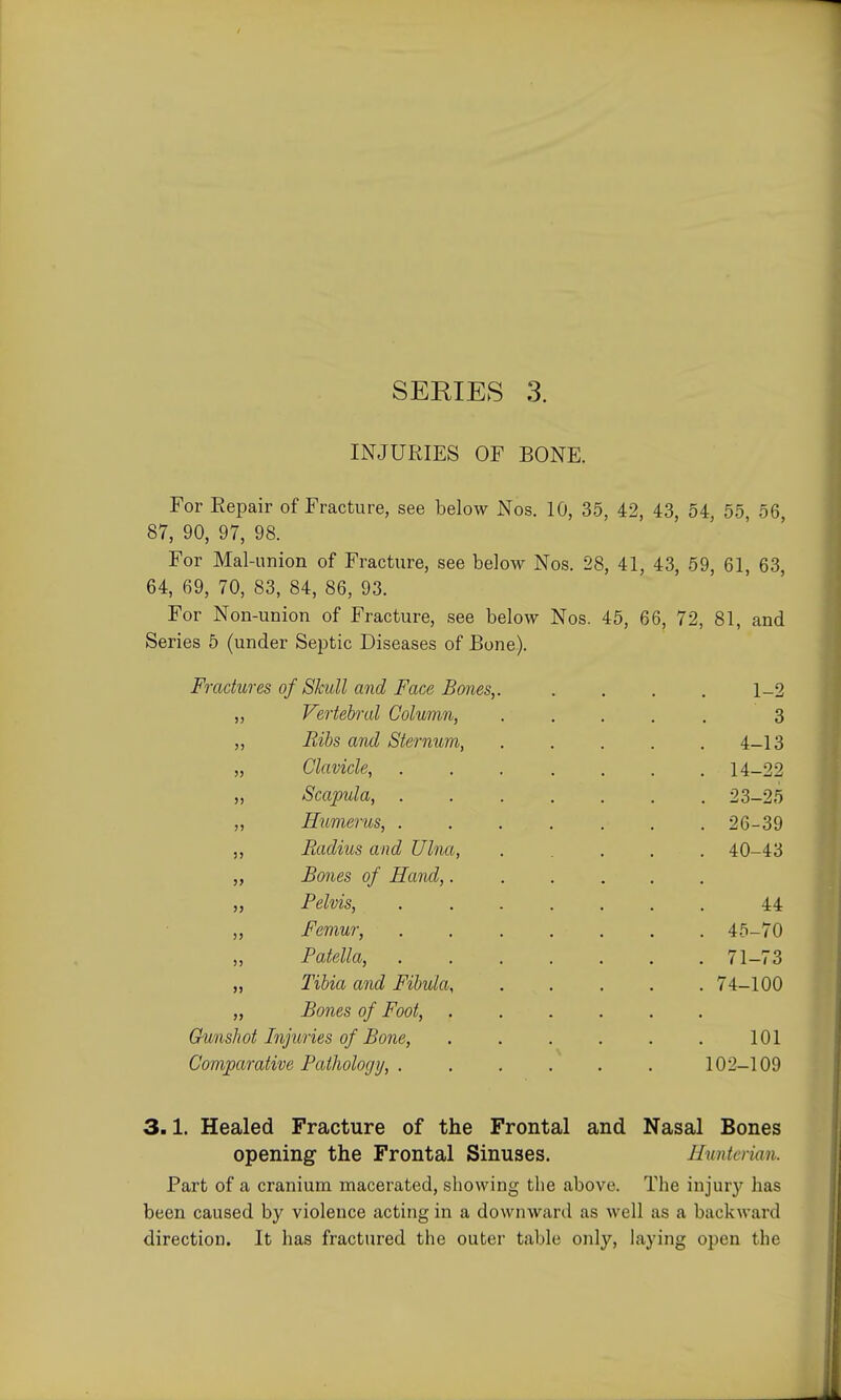 SERIES 3. INJURIES OF BONE. For Eepair of Fracture, see below Nos. 10, 35, 42, 43, 54, 55, 56, 87, 90, 97, 98. For Mal-union of Fracture, see below Nos. 28, 41, 43, 59, 61, 63, 64, 69, 70, 83, 84, 86, 93. For Non-union of Fracture, see below Nos. 45, 66, 72, 81, and Series 5 (under SejDtic Diseases of Bone). Fractures of Skull and Face Bones,. . . . . 1-2 „ Vertebral Column, ..... 3 „ Ribs and Sternum, 4-13 „ Clavicle, 14-22 J, Scapula, ....... 23-25 „ Humerus, ....... 26-39 Radius and Ulna, ..... 40-43 „ Bones of Hand,...... „ Pelvis, ....... 44 „ Femur, ....... 45-70 „ Patella, 71-73 „ Tibia and Fibula, 74-100 „ Bones of Foot, ...... Gunshot Injuries of Bone, . . . . . . 101 Comparative Pathology, . . . . . . 102-109 3.1. Healed Fracture of the Frontal and Nasal Bones opening the Frontal Sinuses. Huntcrian. Part of a cranium macerated, showing the above. The injury has been caused by violence acting in a downward as well as a backward direction. It has fractured the outer table only, laying open the