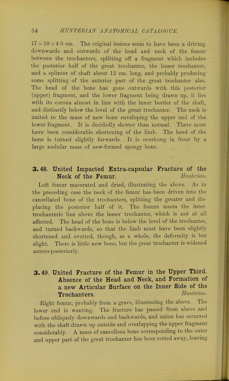 17 X 10 X 4-5 cm. The original lesions seem to have been a driving downwards and outwards of the head and neck of the femur between the trochanters, splitting off a fragment which includes the posterior half of the great trochanter, the lesser trochanter, and a splinter of shaft about 12 cm. long, and probably producing some splitting of the anterior part of the great trochanter also. The head of the bone has gone outwards with this posterior (upper) fragment, and the lower fragment being drawn up, it lies with its corona almost in line with the inner border of the shaft, and distinctly below the level of the great trochanter. The neck is united to the mass of new bone enveloping the upper end of the lower fragment. It is decidedly shorter than normal. There must have been considerable shortening of the limb. The head of the bone is turned slightly forwards. It is overhung in front by a large nodular mass of new-formed spongy bone. 3.48. United Impacted Extra-capsular Fracture of the Neck of the Femur. Hunterian. Left femur macerated and dried, illustrating the above. As in the preceding case the neck of the femur has been driven into the cancellated bone of the trochanters, splitting the greater and dis- placing the posterior half of it. The fissure meets the inter- trochanteric line above the lesser trochanter, which is not at all affected. The head of the bone is below the level of the trochanter, and turned backwards, so that the limb must have been shghtly shortened and everted, though, as a whole, the deformity is but slight. There is little new bone, but the great trochanter is widened antero-posteriorly. 3.49. United Fracture of the Femur in the Upper Third. Absence of the Head and Neck, and Formation of a new Articular Surface on the Inner Side of the Trochanters. Hunterian. Right femur, probably from a grave, illustrating the above. The lower end is wanting. The fracture has passed from above and before obliquely downwards and backwards, and union has occurred with the shaft drawn up outside and overlapping the upper fragment considerably. A mass of cancellous bone corresponding to the outer and upper part of the great trochanter has been rotted away, leaving