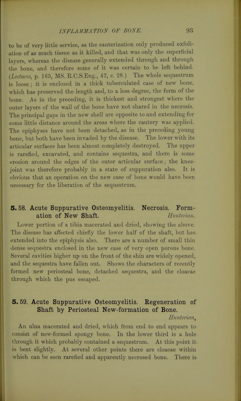to be of very little service, as the cauterization only produced exfoli- ation of as much tissue as it killed, and that was only the superficial layers, whereas the disease generally extended through and through the bone, and therefore some of it was certain to be left behind. {Lectures, p. 165, MS. RC.S.Eng., 42, c. 28.) The whole sequestruu> is loose; it is enclosed in a thick tuberculated case of new bone, which has preserved the length and, to a less degree, the form of the bone. As in the preceding, it is thickest and strongest where the outer layers of the wall of the bone have not shared in the necrosis. The principal gaps in the new shell are opposite to and extending for some little distance around the areas where the cautery was applied. The epiphyses have not been detached, as in the preceding young bone, but both have been invaded by the disease. The lower with its articular surfaces has been almost completely destroyed. The upper is rarefied, excavated, and contains sequestra, and there is some erosion around the edges of the outer articular surface; the knee- joint was therefore probably in a state of suppuration also. It is obvious that an operation on the new case of bone would have been necessary for the liberation of the sequestrum. 5.58. Acute Suppurative Osteomyelitis. Necrosis. Form- ation of New Shaft. Hvnterian. Lower portion of a tibia macerated and dried, showing the above. The disease has affected chiefly the lower half of the shaft, but has extended into the epiphysis also. There are a number of small thin dense sequestra enclosed in the neAv case of very open porous bone. Several cavities higher up on the front of the shin are widely opened, and the sequestra have fallen out. Shows the characters of recently formed new periosteal bone, detached sequestra, and the cloacae through which the pus escaped, 5. 59. Acute Suppurative Osteomyelitis. Regeneration of Shaft by Periosteal New-formation of Bone. Hunteiian^ An ulna macerated and dried, which from end to end appears to consist of new-formed spongy bone. In the lower third is a hole through it which probably contained a sequestrum. At this point it is bent slightly. At several other points there are cloacae within which can be seen rarefied and apparently necrosed bone. There is