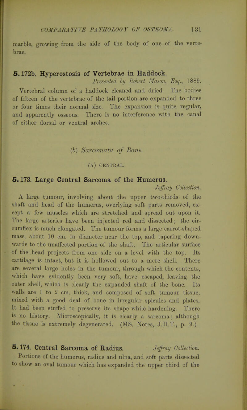 marble, growing from the side of the body of one of the verte- brae. 5.172b. Hyperostosis of Vertebrae in Haddock. Presented hi/ liobert Mason, Esq., 1889. Vertebral column of a haddock cleaned and dried. The bodies of fifteen of the vertebrae of the tail portion are expanded to three or four times their normal size. The expansion is quite regular, and apparently osseous. There is no interference with the canal of either dorsal or ventral arches. (6) Sarcomata of Bone. (a) central. 5.173. Large Central Sarcoma of the Humerus. Jeffray Collection, A large tumour, involving about the upper two-thirds of the shaft and head of the humerus, overlying soft parts removed, ex- cept a few muscles which are stretched and spread out upon it. The large arteries have been injected red and dissected; the cir- cumflex is much elongated. The tumour forms a large carrot-shaped mass, about 10 cm. in diameter near the top, and tapering down- wards to the unaffected portion of the shaft. The articular surface of the head projects from one side on a level with the top. Its cartilage is intact, but it is hollowed out to a mere shell. There are several large holes in the tumour, through which the contents, which have evidently been very soft, have escaped, leaving the outer shell, Avhich is clearly the expanded shaft of the bone. Its walls are 1 to 2 cm. thick, and composed of soft tumour tissue, mixed with a good deal of bone in irregular spicules and plates. It had been stuffed to preserve its shape while hardening. There is no history. Microscopically, it is clearly a sarcoma; although the tissue is extremely degenerated. (MS. Notes, J.H.T., p. 9.) 5.174. Central Sarcoma of Radius. Jeffray Colledion. Portions of the humerus, radius and ulna, and soft parts dissected to show an oval tumour which has expanded the upper third of the