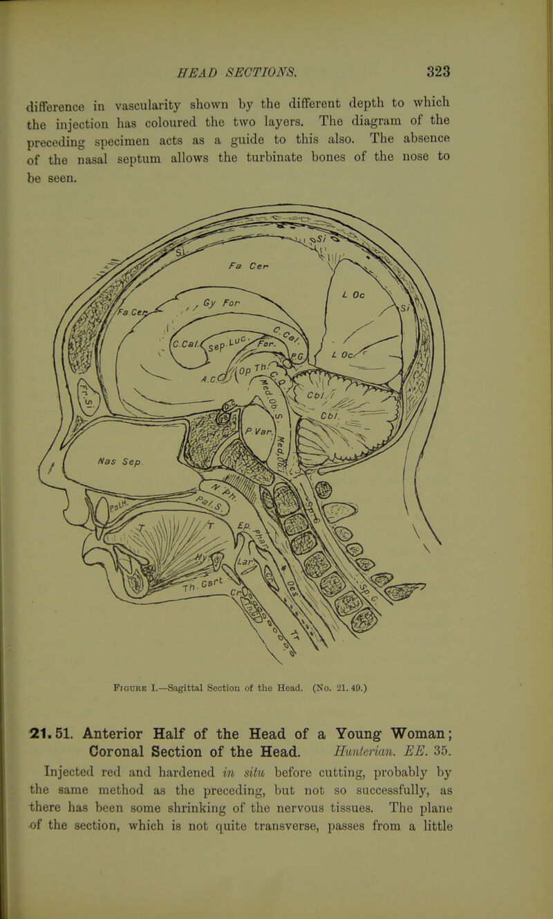 difference in vascularity shown by the different depth to which the injection has coloured the two layers. The diagram of the preceding specimen acts as a guide to this also. The absence of the nasal septum allows the turbinate bones of the nose to be seen. Figure I.—Sagittal Section of the Head. (No. 21. 49.) 21.51. Anterior Half of the Head of a Young Woman; Coronal Section of the Head. Hunterian. EE. 35. Injected red and hardened in situ before cutting, probably by the same method as the preceding, but not so successfully, as there has been some shrinking of the nervous tissues. The plane of the section, which is not quite transverse, passes from a little