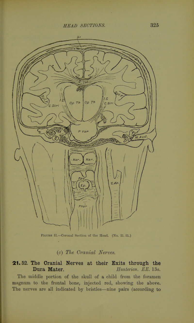 Figure II.—Coronal Section of the Head. (No. 21. 51.) (c) The Cranial Nerves. 21.52. The Cranial Nerves at their Exits through the Dura Mater. Hunterim. EE. 13a. The middle portion of the skull of a child from the foramen magnum to the frontal bone, injected red, showing the above. The nerves are all indicated by bristles—nine pairs (according to I