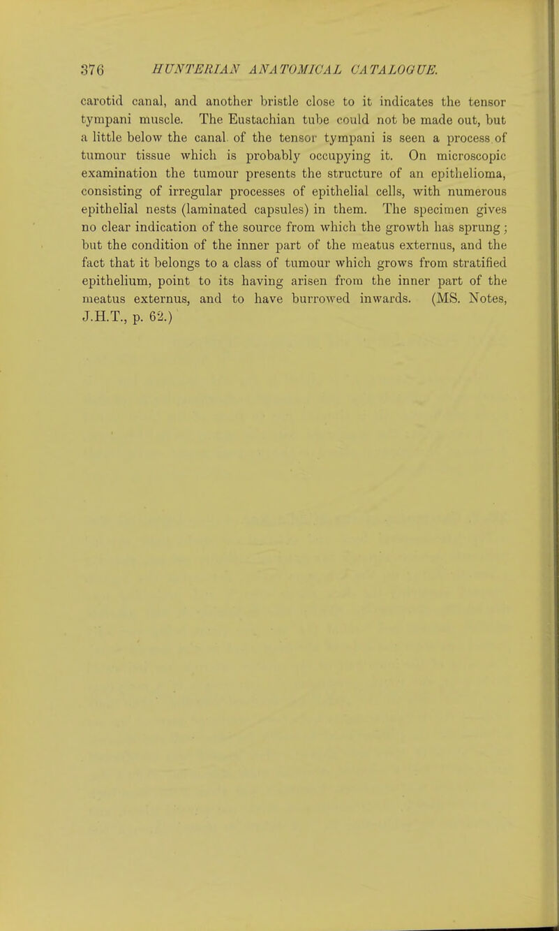 carotid canal, and another bristle close to it indicates the tensor tympani muscle. The Eustachian tube could not be made out, but a little below the canal, of the tensor tympani is seen a process of tumour tissue which is probably occupying it. On microscopic examination the tumour presents the structure of an epithelioma, consisting of irregular processes of epithelial cells, with numerous epithelial nests (laminated capsules) in them. The specimen gives no clear indication of the source from which the growth has sprung; but the condition of the inner part of the meatus externus, and the fact that it belongs to a class of tumour which grows from stratified epithelium, point to its having arisen from the inner part of the meatus externus, and to have burrowed inwards. (MS. Notes, J.H.T., p. 62.)