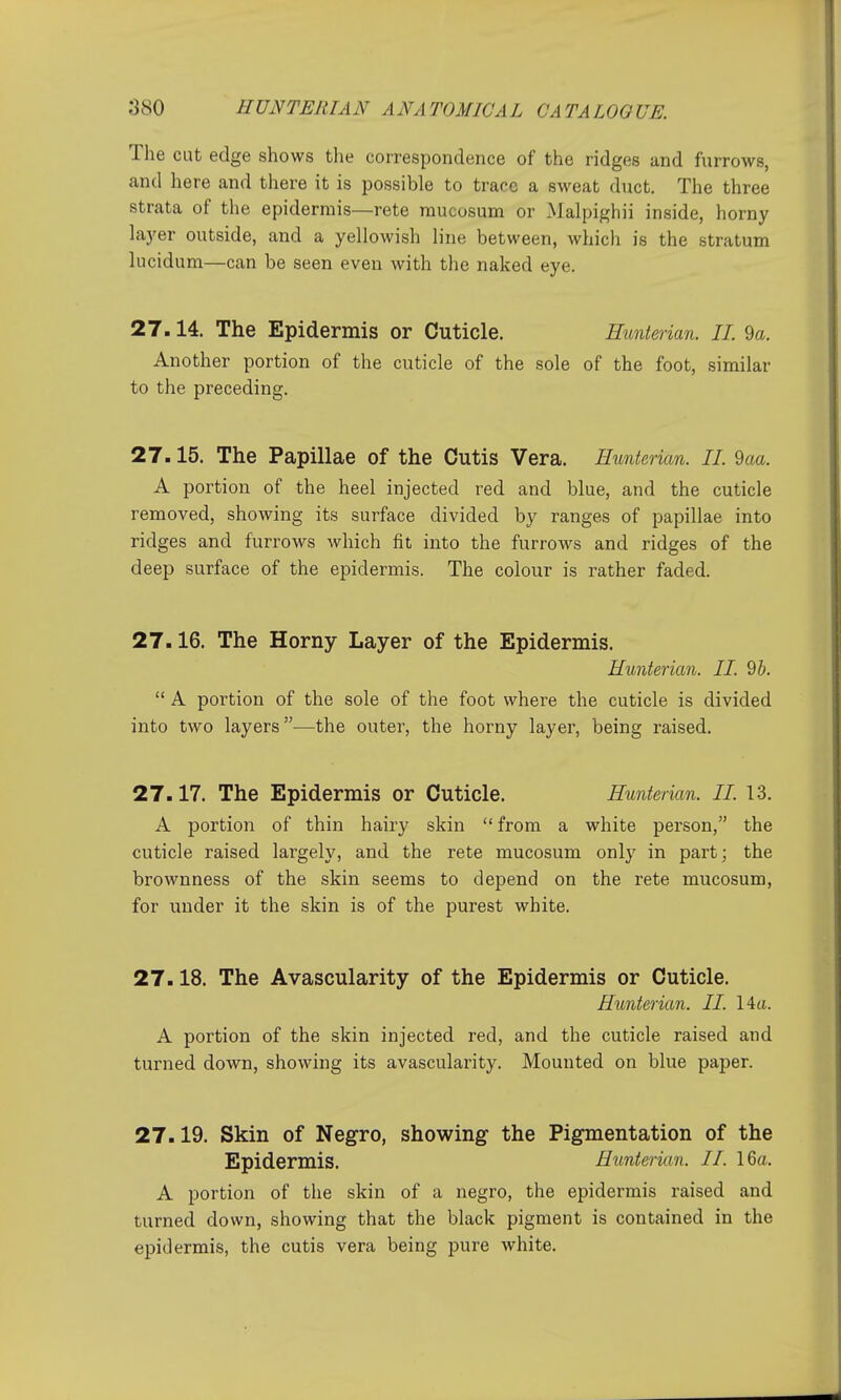The cut edge shows the correspondence of the ridges and furrows, and here and there it is possible to trace a sweat duct. The three strata of the epidermis—rete mucosum or Malpighii inside, horny layer outside, and a yellowish line between, which is the stratum lucidum—can be seen even with the naked eye. 27.14. The Epidermis or Cuticle. Huntei ian. II. 9a. Another portion of the cuticle of the sole of the foot, similar to the preceding. 27.15. The Papillae of the Cutis Vera. Eunterian. II. 9aa. A portion of the heel injected red and blue, and the cuticle removed, showing its surface divided by ranges of papillae into ridges and furrows which fit into the furrows and ridges of the deep surface of the epidermis. The colour is rather faded. 27.16. The Horny Layer of the Epidermis. Hunter ian. II. 9b.  A portion of the sole of the foot where the cuticle is divided into two layers—the outer, the horny layer, being raised. 27.17. The Epidermis or Cuticle. Hunterian. II. 13. A portion of thin hairy skin from a white person, the cuticle raised largely, and the rete mucosum only in part; the brownness of the skin seems to depend on the rete mucosum, for under it the skin is of the purest white. 27.18. The Avascularity of the Epidermis or Cuticle. Hunterian. II. 14a. A portion of the skin injected red, and the cuticle raised and turned down, showing its avascularity. Mounted on blue paper. 27.19. Skin of Negro, showing- the Pigmentation of the Epidermis. Hunterian. II. 16fl. A portion of the skin of a negro, the epidermis raised and turned down, showing that the black pigment is contained in the epidermis, the cutis vera being pure white.