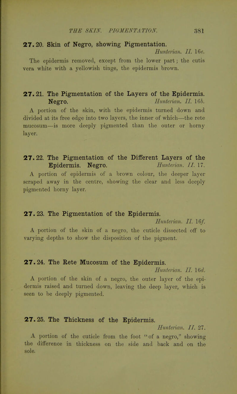 THE SKIN. PlUMEiVTAT/OiV. HSl 27.20. Skin of Negro, showing Pigmentation. Himtenan. II. 16e, The epidermis removed, except from the lower part; the cutis vera wliite with a yellowish tinge, the epidermis brown. 27.21. The Pigmentation of the Layers of the Epidermis. Negro. Hunterian. II. IGi. A portion of the skin, with the epidermis turned down and divided at its free edge into two layers, the inner of which—the rete mucosum—is more deeply pigmented than the outer or horny layer. 27.22. The Pigmentation of the DiflTerent Layers of the Epidermis. Negro. Eunterian. II. 17. A portion of epidermis of a brown colour, the deeper layer scraped away in the centre, showing the clear and less deeply pigmented horny layer. 27.23. The Pigmentation of the Epidermis. Hunterian. II. 16/. A portion of the skin of a negro, the cuticle dissected off to varying depths to show the disposition of the pigment. 27.24. The Rete Mucosum of the Epidermis. Hunterian. II. \M. A portion of the skin of a negro, the outer layer of the epi- dermis raised and turned down, leaving the deep layer, Avhich is seen to be deeply pigmented. 27.25. The Thickness of the Epidermis. Huntenan. II. 27. A portion of the cuticle from the foot of a negro, showing the difference in thickness on the side and back and on the sole.